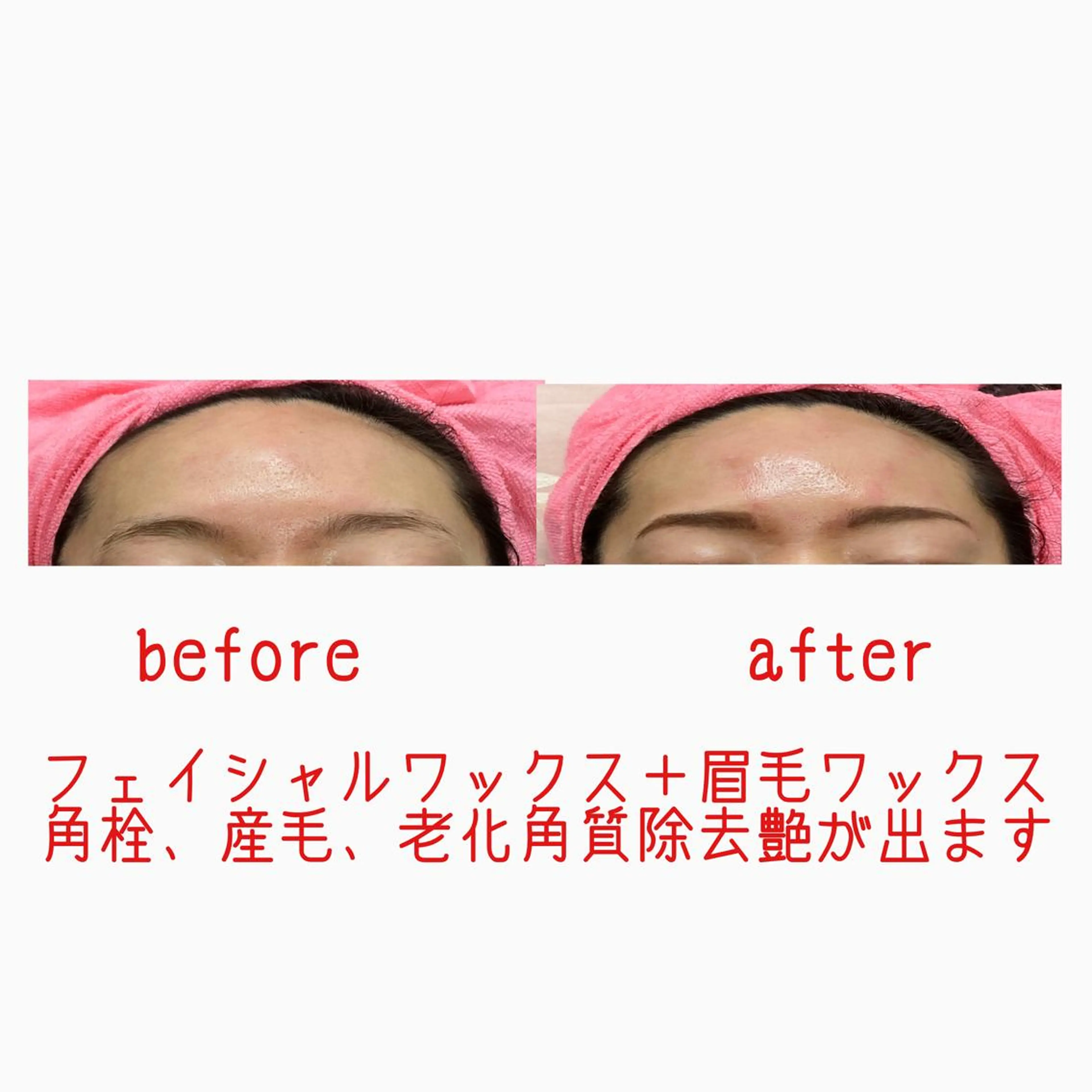 アイブロウ 眉毛ワックス脱毛 オアシス・さくら所属・中村貴子都度払い脱毛 小顔コルギのエステ・リラクイメージ