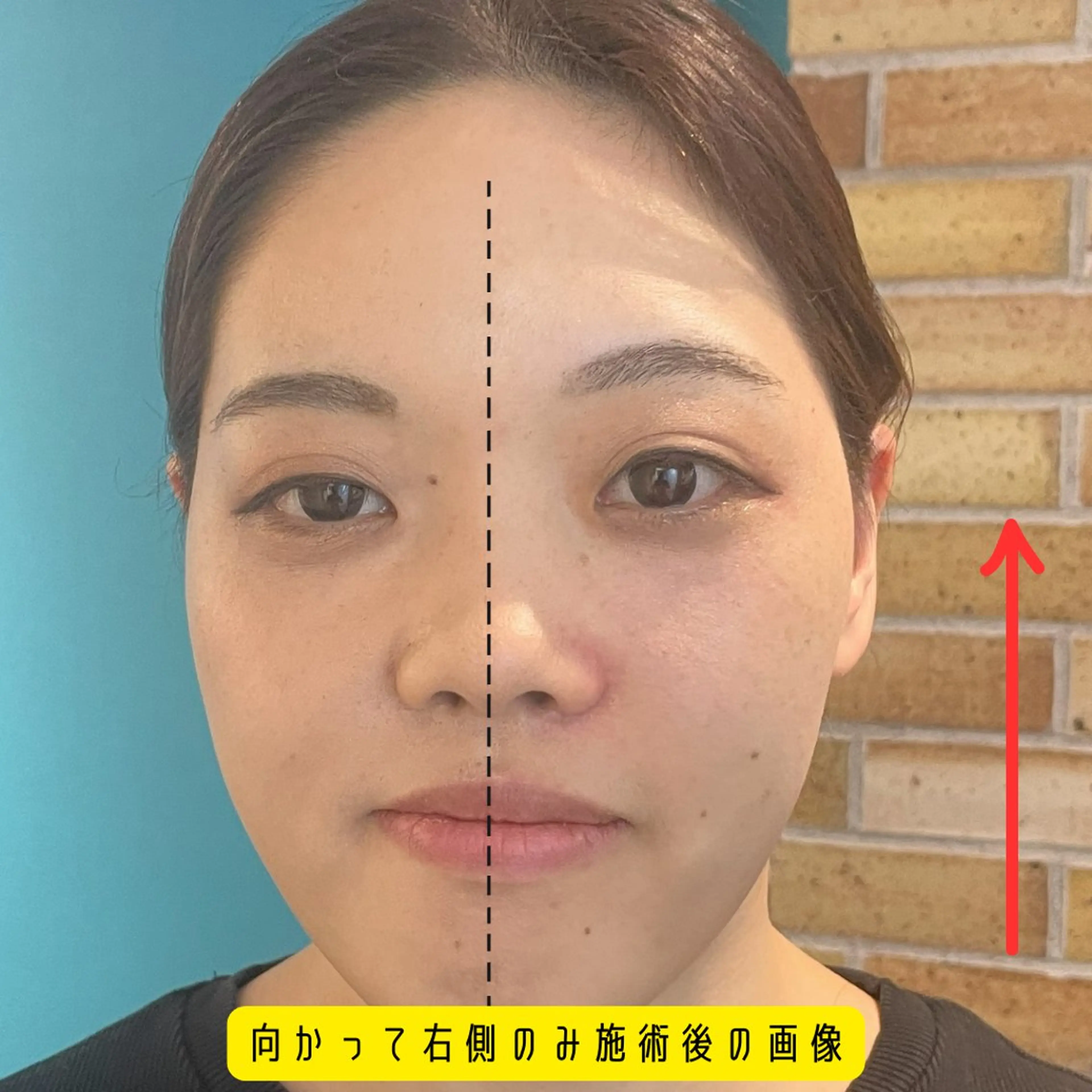 エステ リラク Nexfit for Beauty小顔矯正のエステ・リラクイメージ