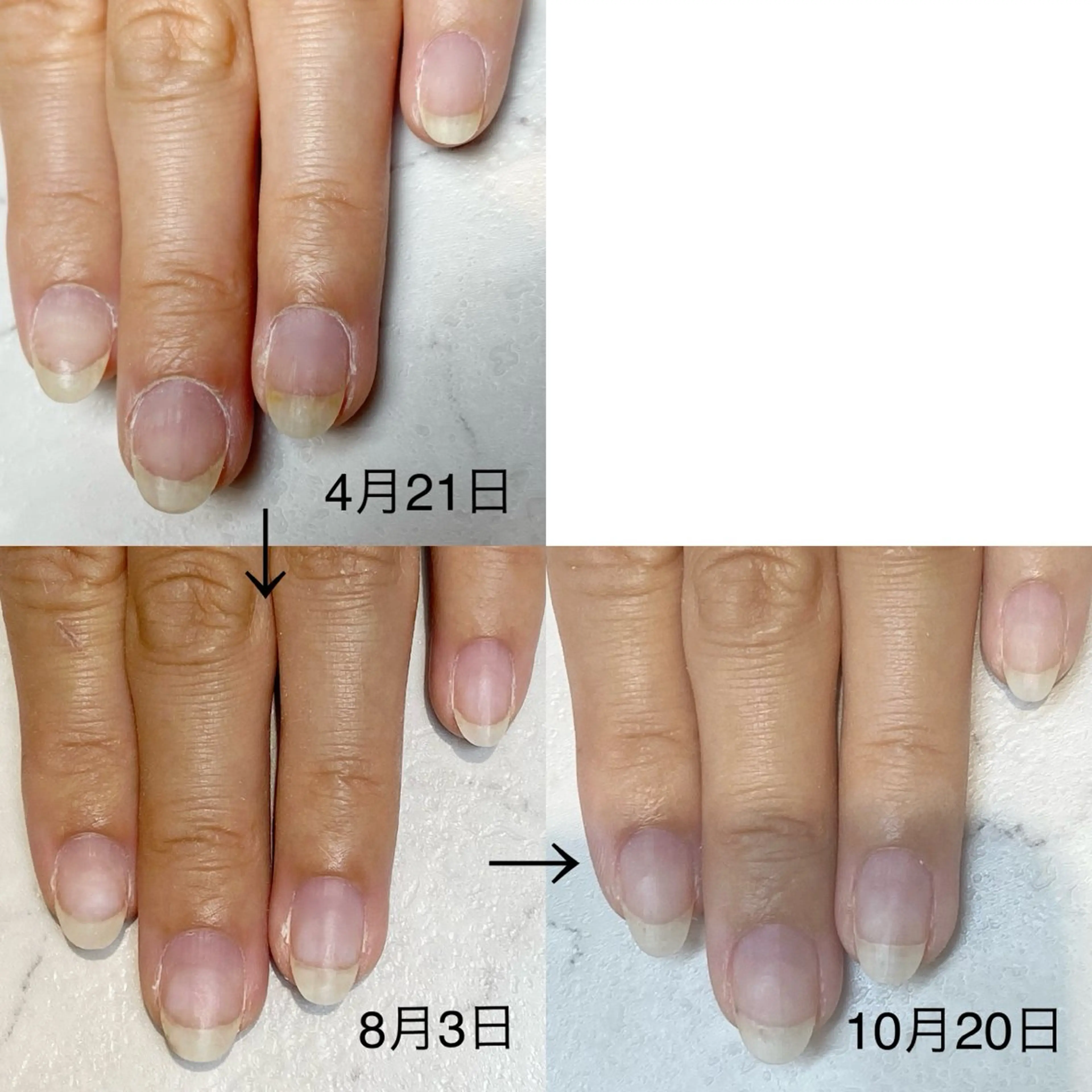ネイル ハンドネイル プライベートサロン Rのネイルデザイン