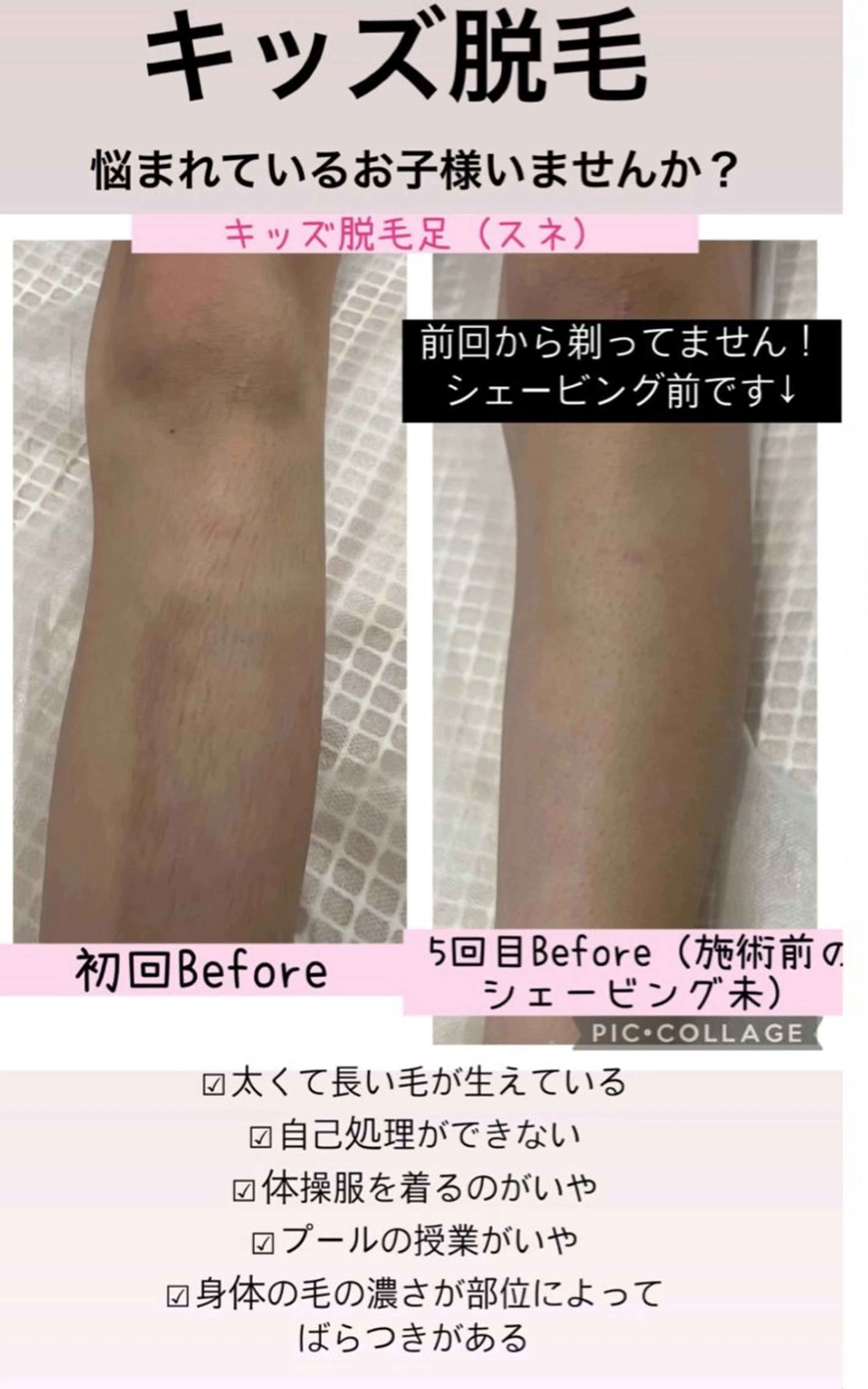 脱毛 ブライダル痩身×脱毛 尼崎駅前サロンのエステ・リラクイメージ