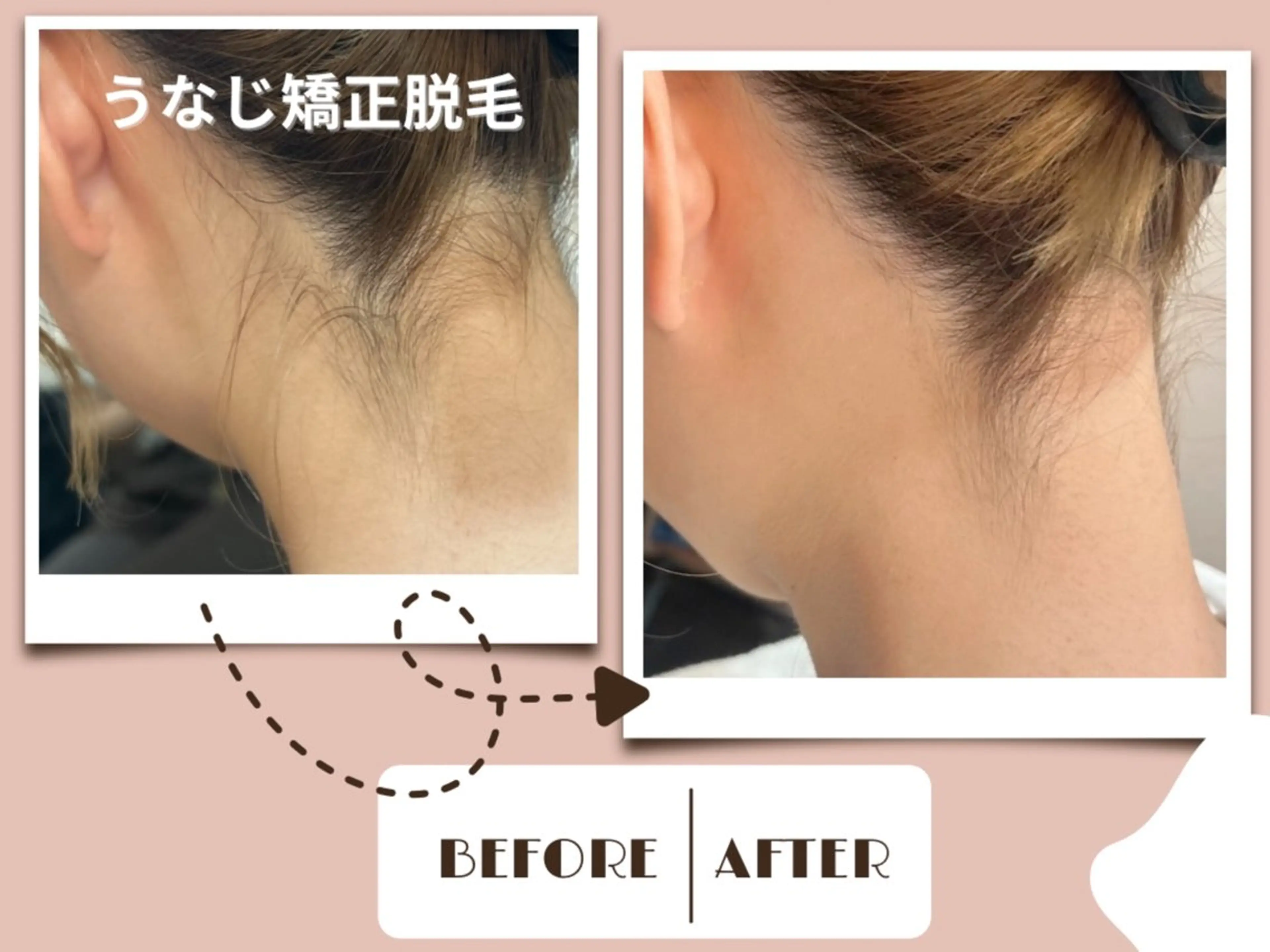 メンズ 脱毛 OPS×LIFE BEAUTY/maiのエステ・リラクイメージ