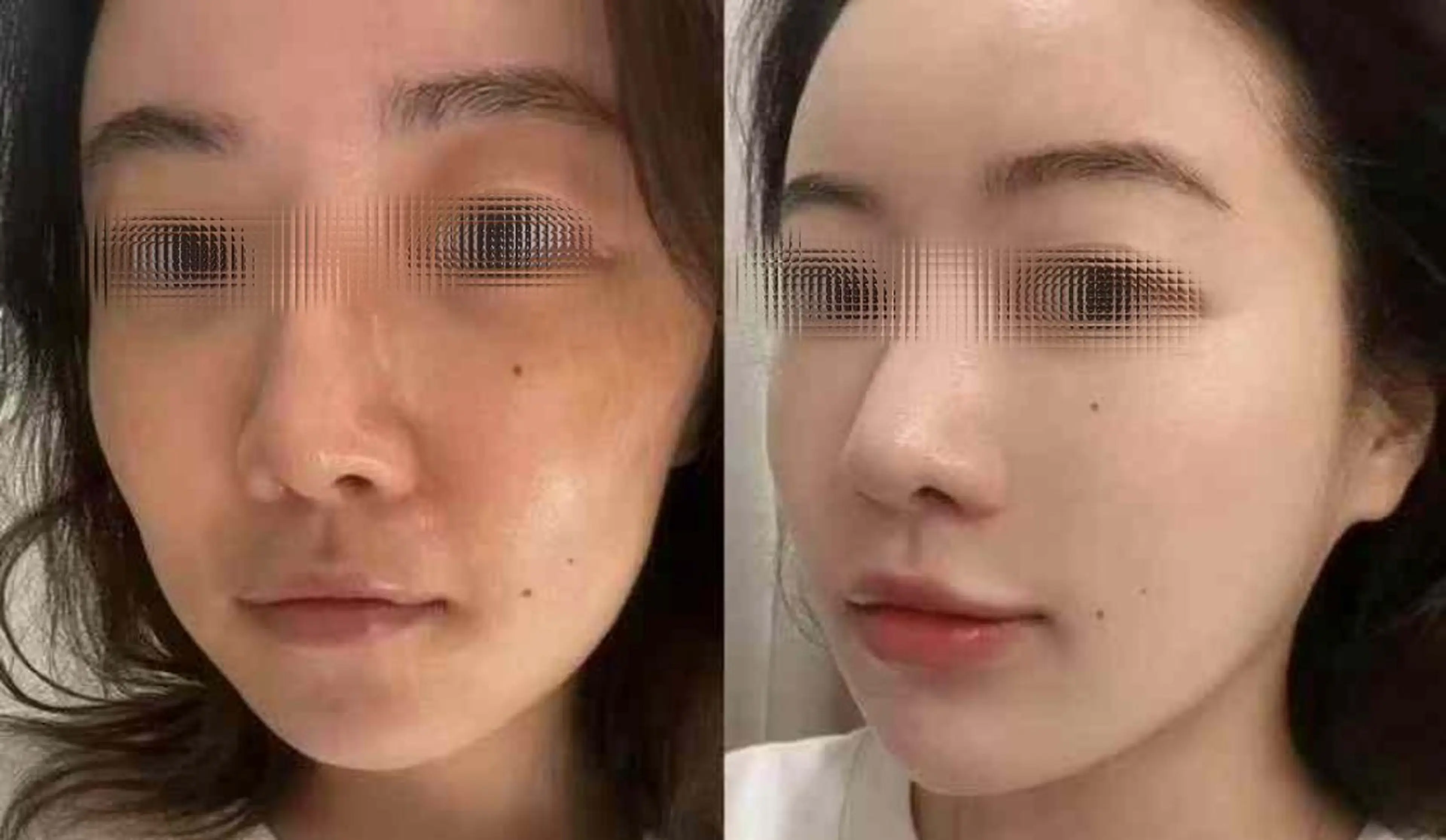 アイブロウ 眉毛ワックス脱毛 aliaハイフ&水光ジェットサロン所属・aliaハーブ水光店 エステティシャン募集のエステ・リラクイメージ