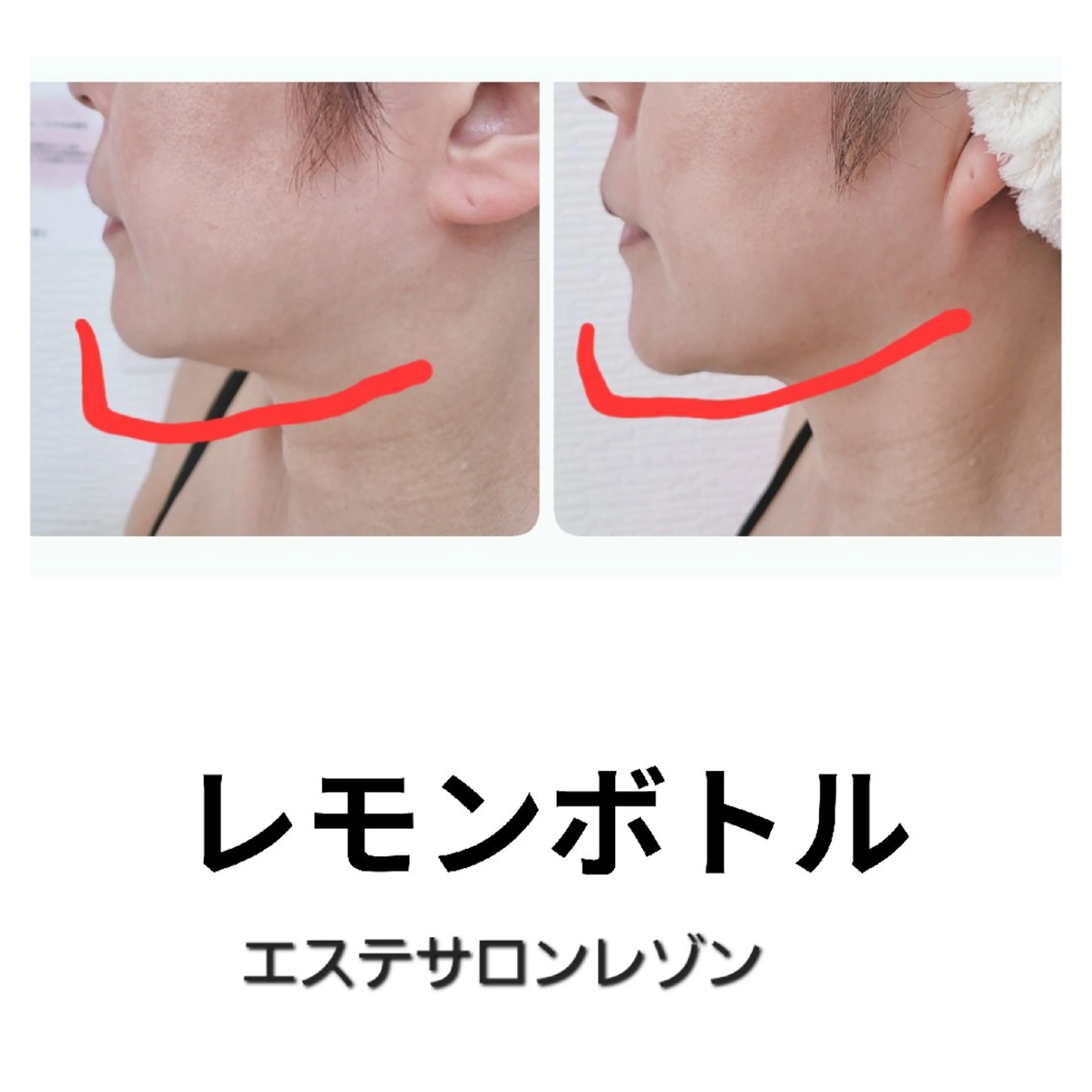 エステ ニキビケア＆ニキビ跡 レゾン京橋店　のエステ・リラクイメージ