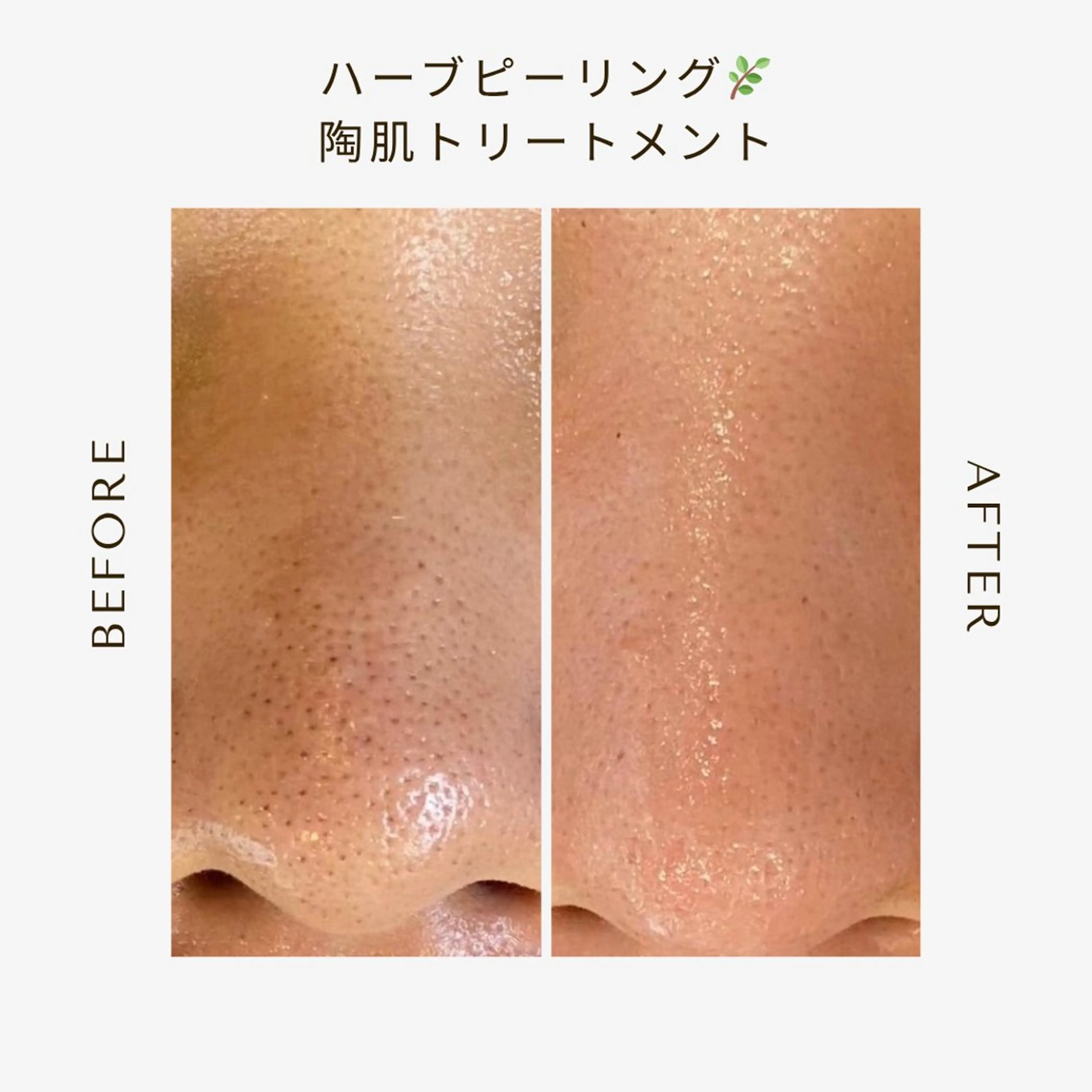 private beauty salon Lilby所属・リルビー 肌質改善・肌育サロンのエステ・リラクイメージ