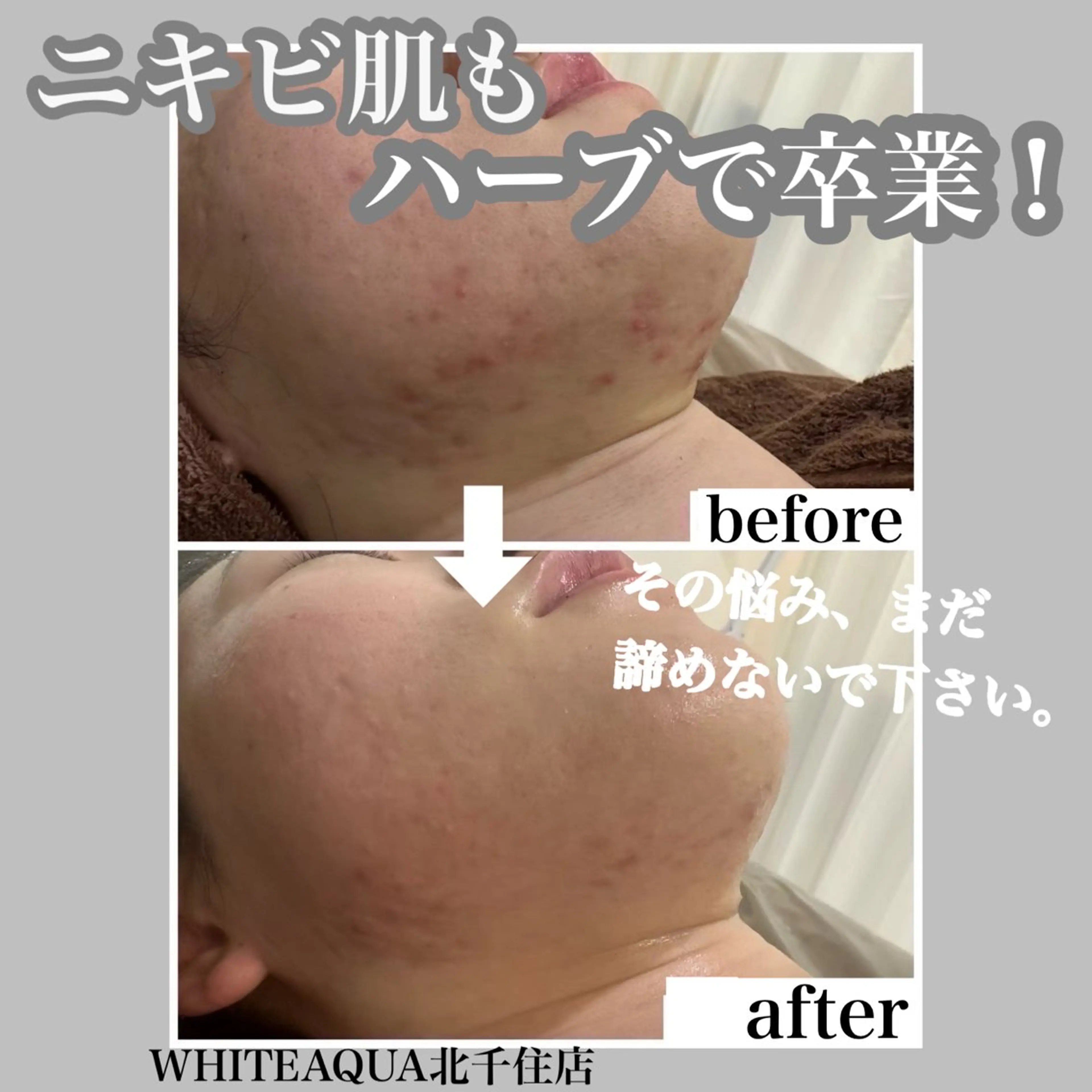 WHITE AQUA 北千住店のエステ・リラクイメージ