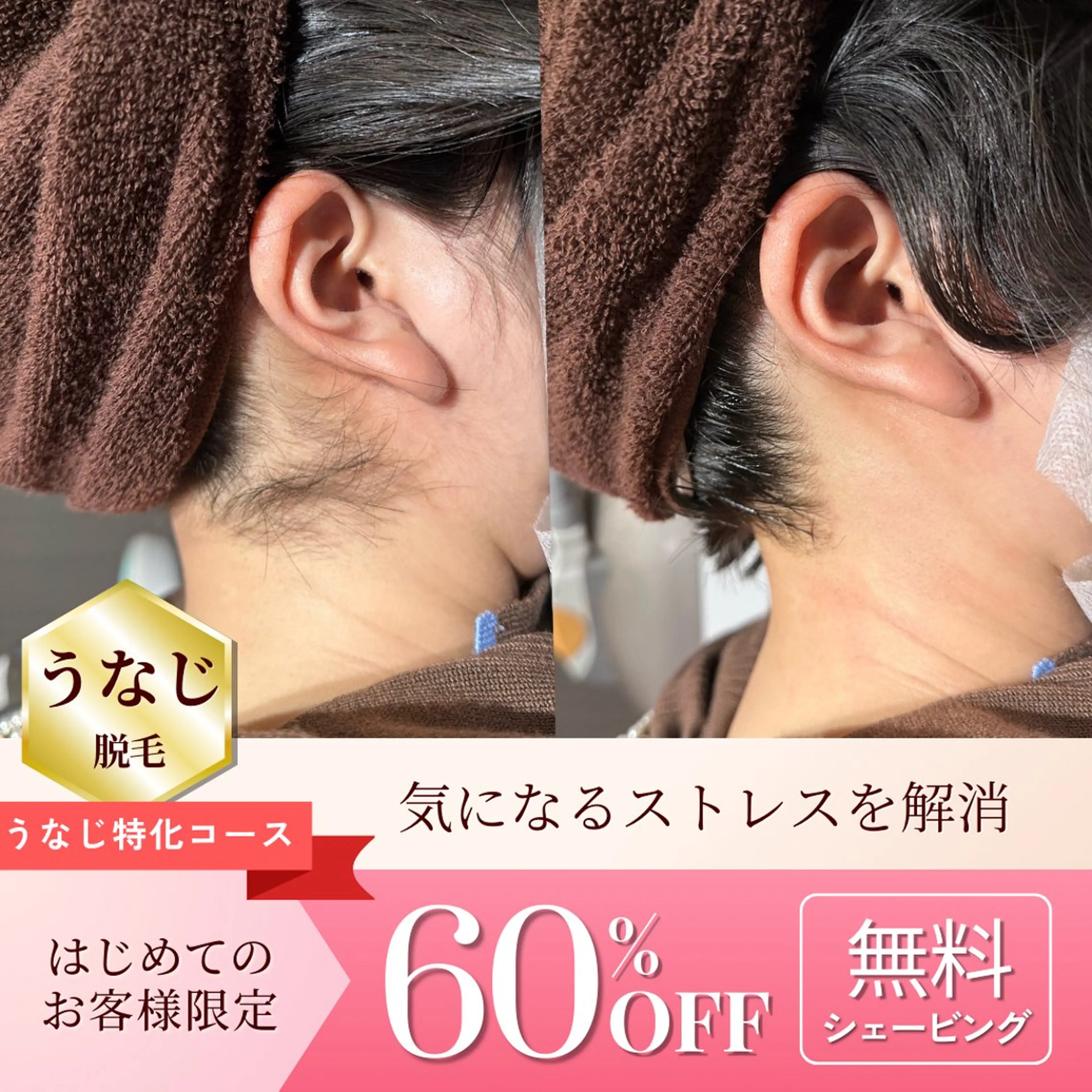 うなじ脱毛🪄シェービング無料サービス🎀✨️通常4,400円→まずはお試し✨️の写真