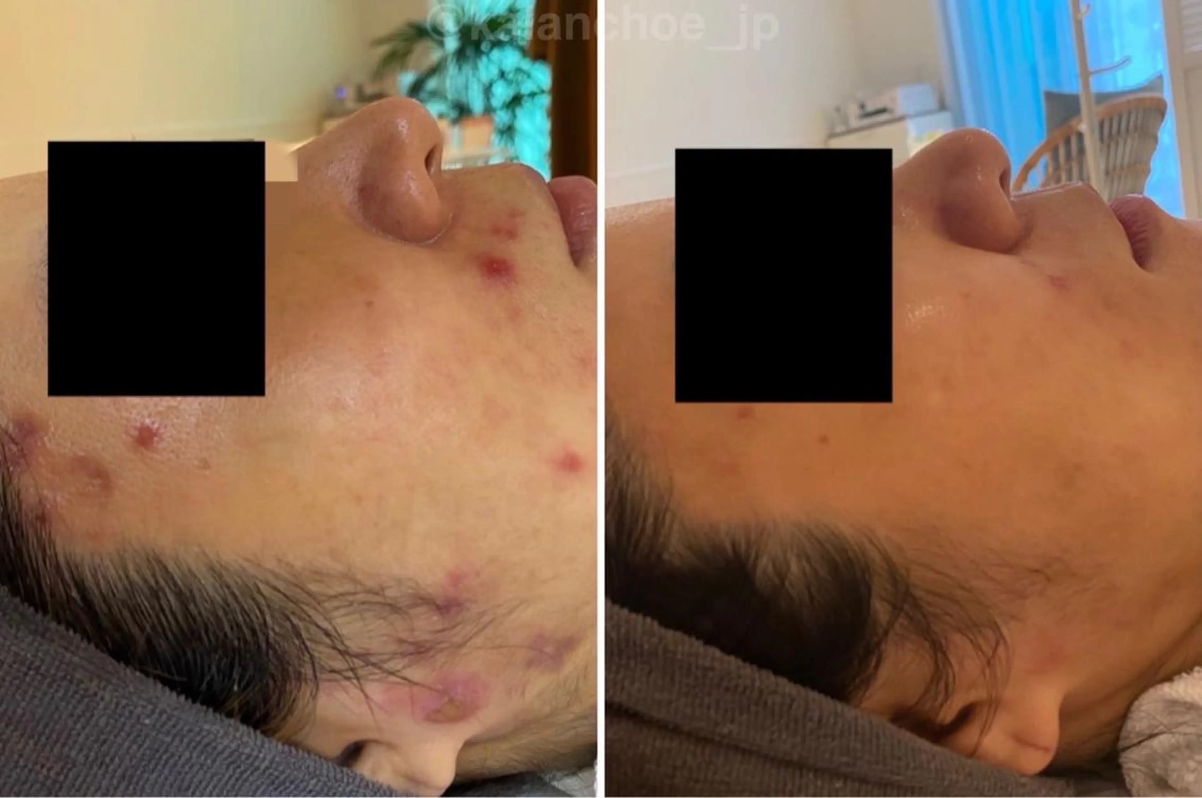 エステ リラク 肌質改善 KALANCHOEのエステ・リラクイメージ