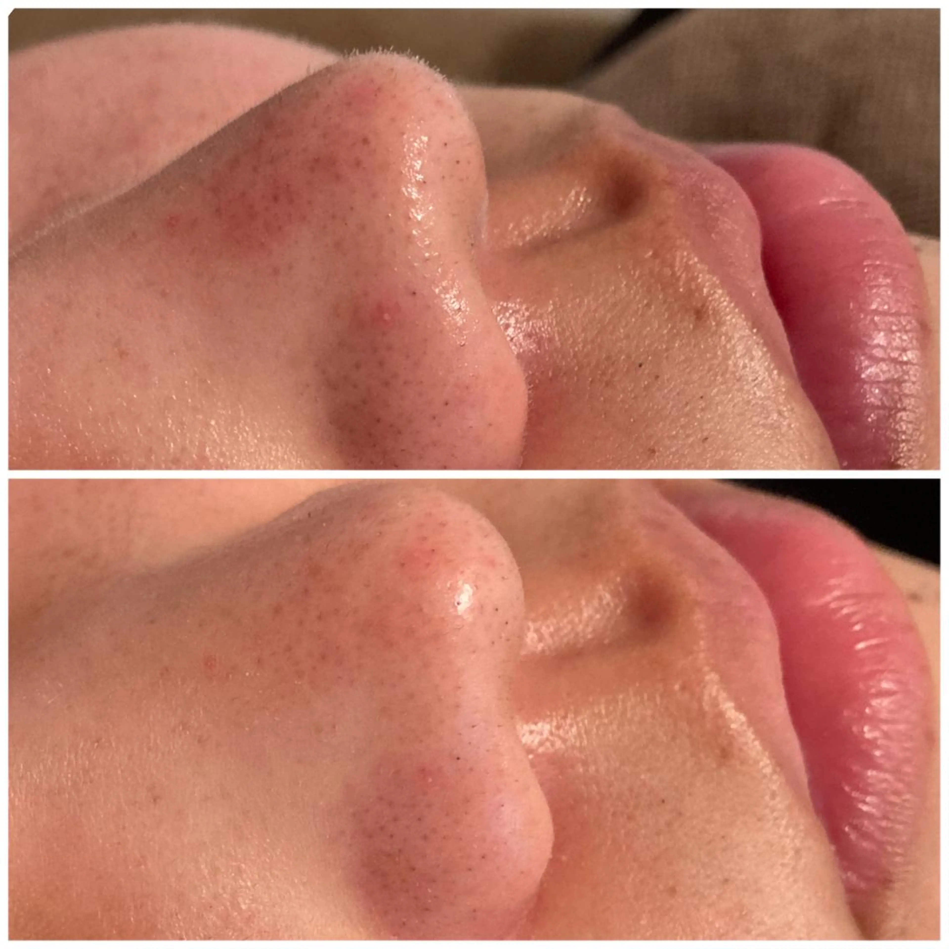 メンズ アイブロウ ワックス脱毛 眉カット その他(アイブロウ) B&H所属・頭痛•肩こり専門/ 眉サロンB&H心斎橋のエステ・リラクイメージ