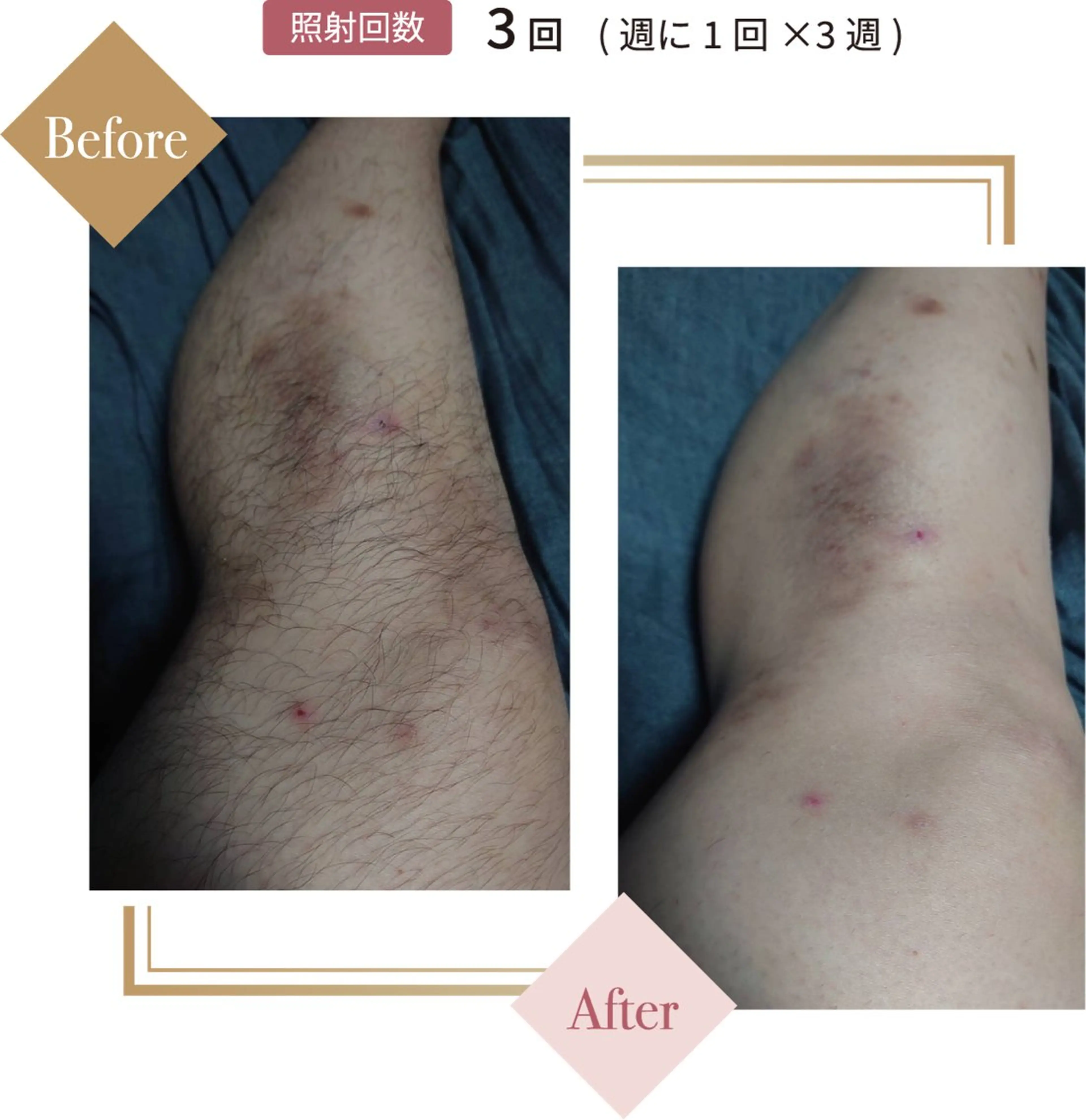 ニキビ、痩身、脱毛、 サクラチャンスパのエステ・リラクイメージ