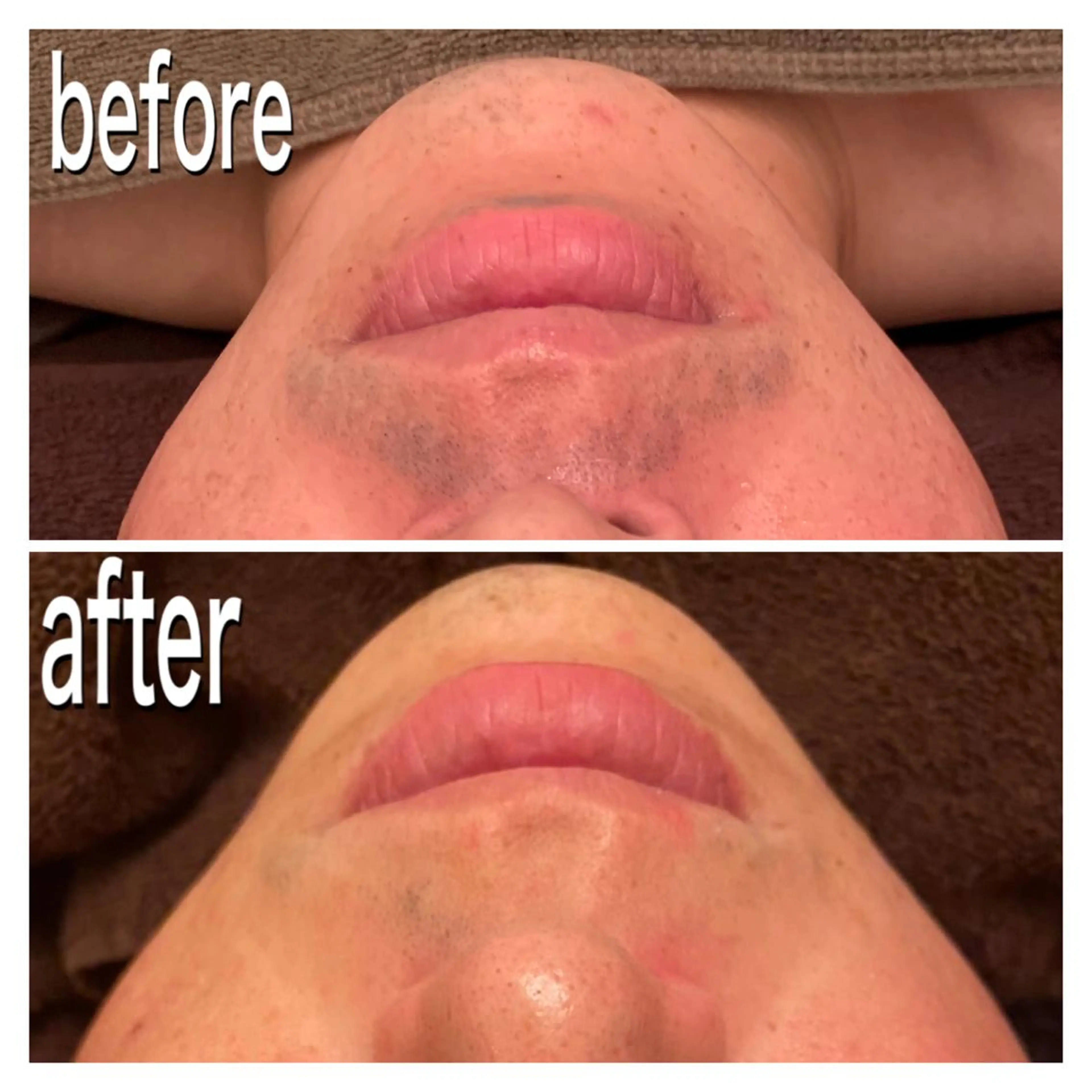 食べながら魅せボディ éclatJua川越のエステ・リラクイメージ