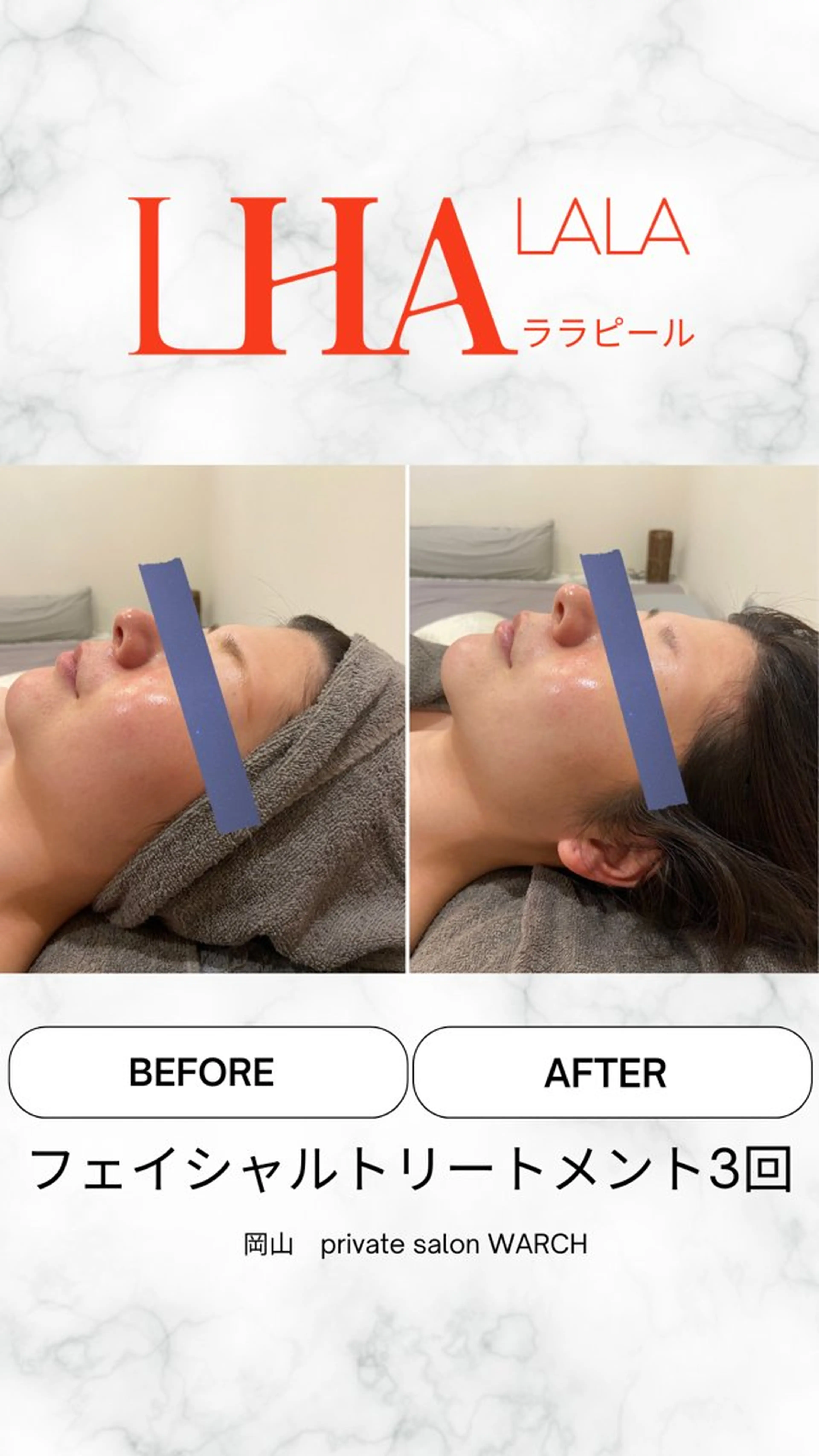 ララピールの写真