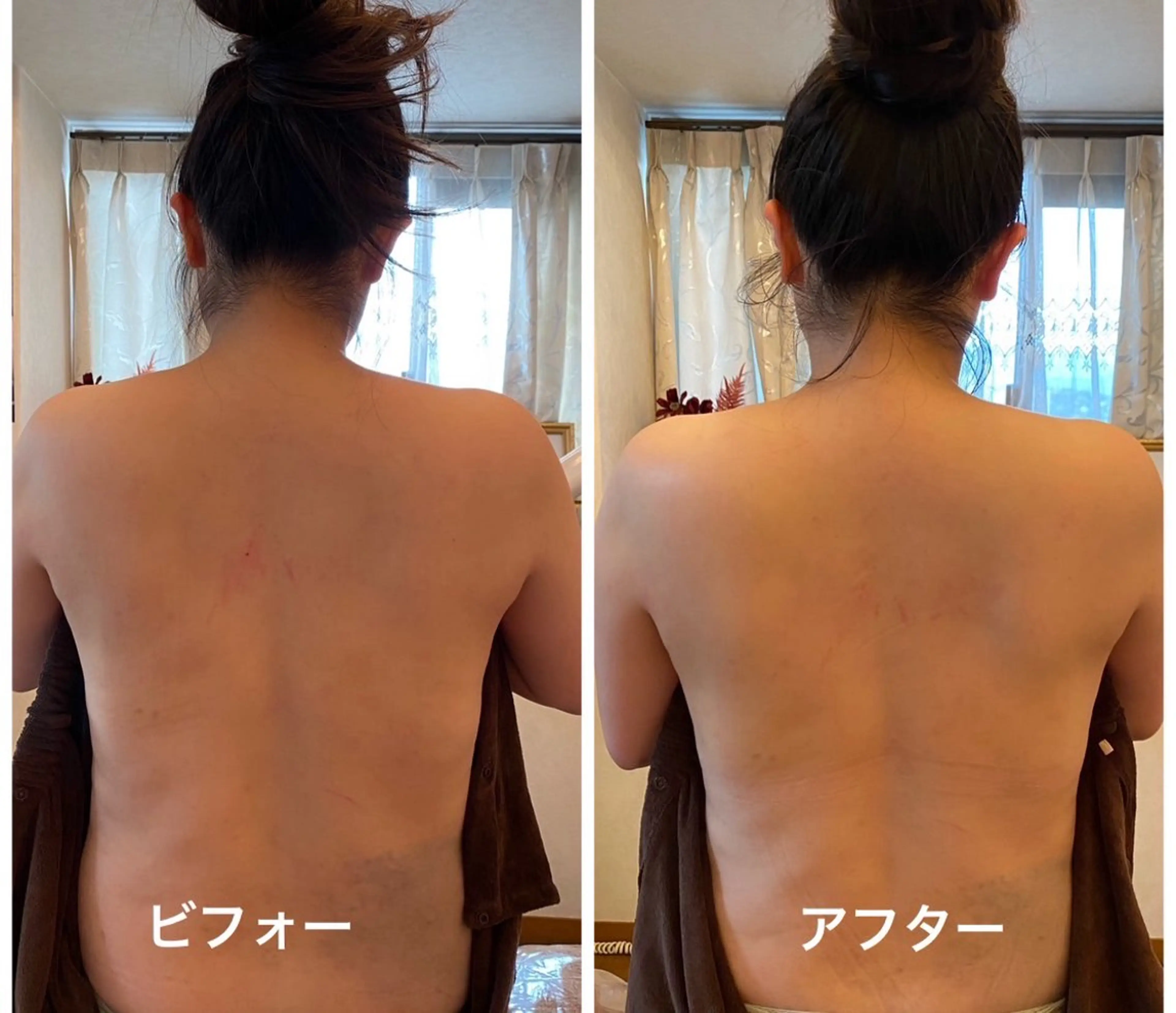 esther上半身ケアトリートメント👐上半身を念入りに‼️背中のハリや歪み、姿勢の悪さが気になる方💦痛み有🈶の写真