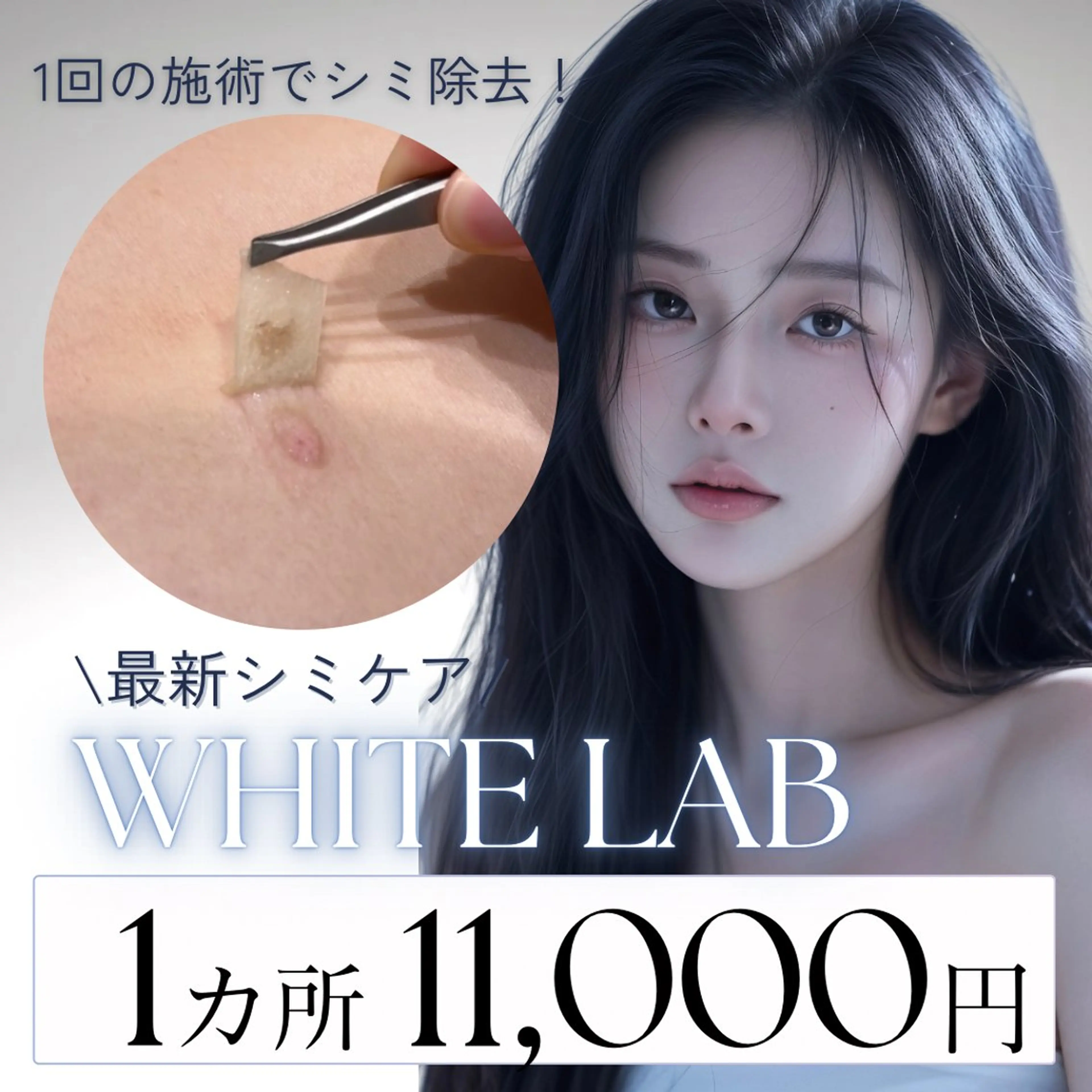 ホワイトラボ🫧シミ1ヶ所11000円の写真