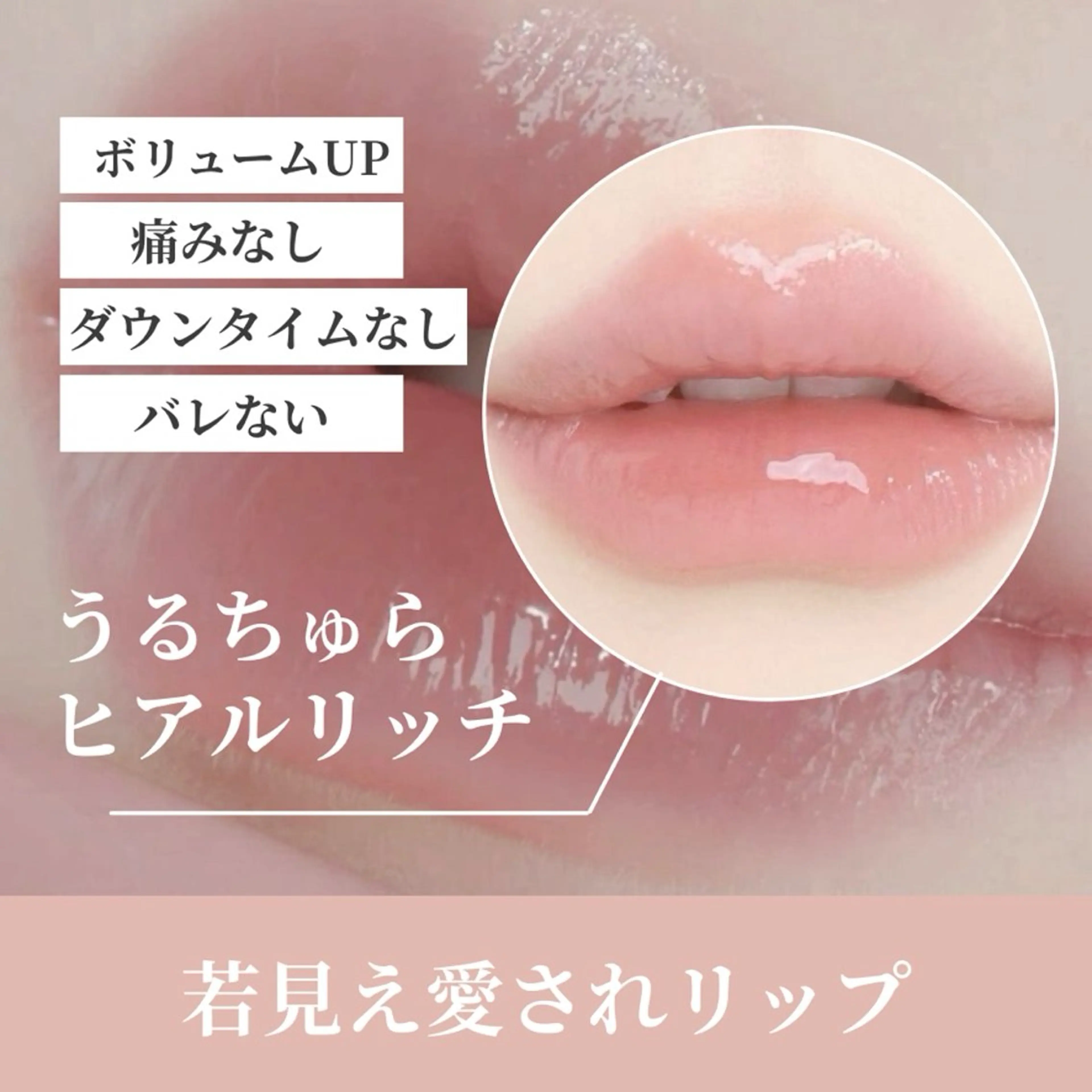 『人中短縮＋小鼻縮小』キュッと短く★美人黄金比集中ケア♦︎看護師施術×医療提携マシンでお顔の中心を司る部分を改善の写真