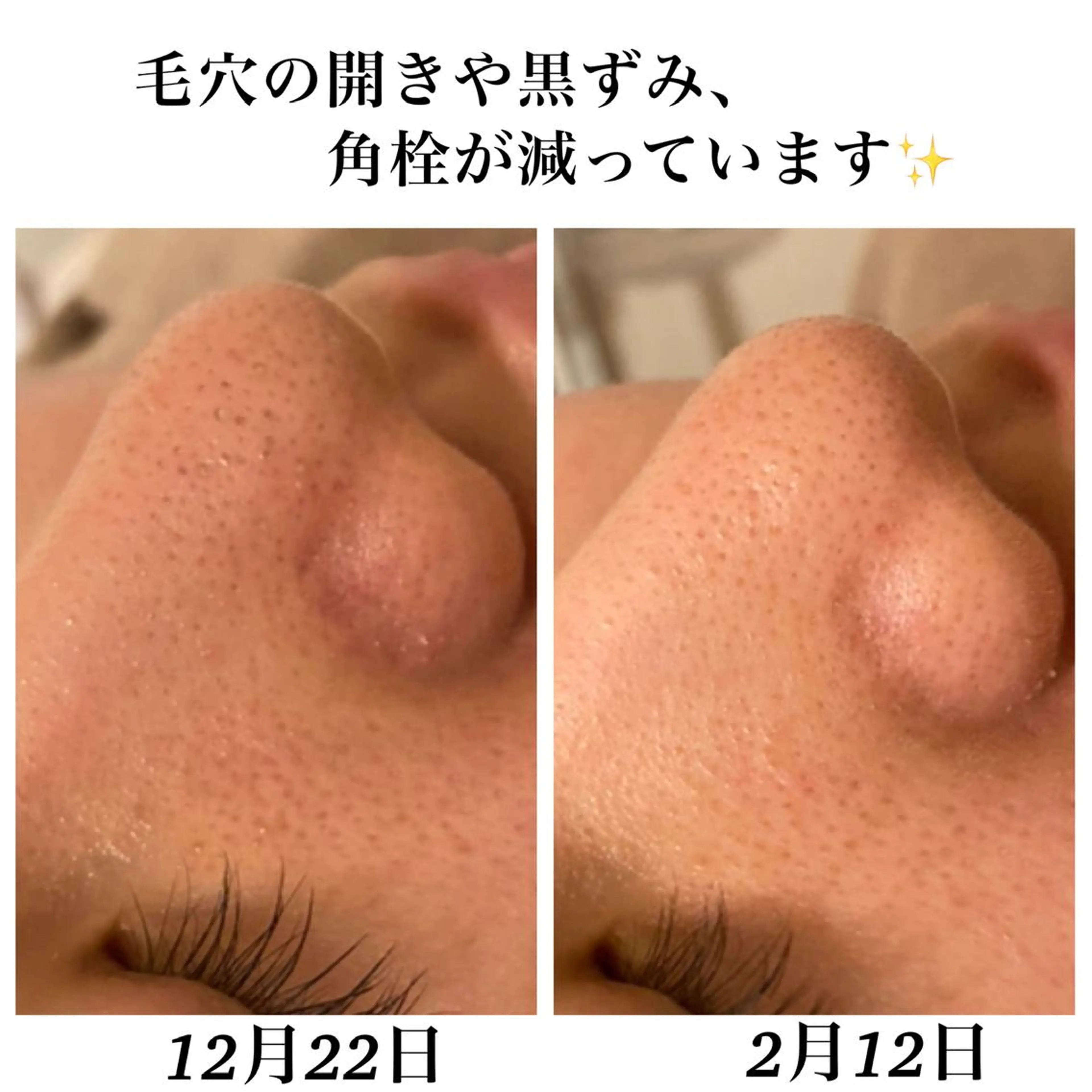 エステ リラク Bellesthe （ベルエステ）のエステ・リラクイメージ