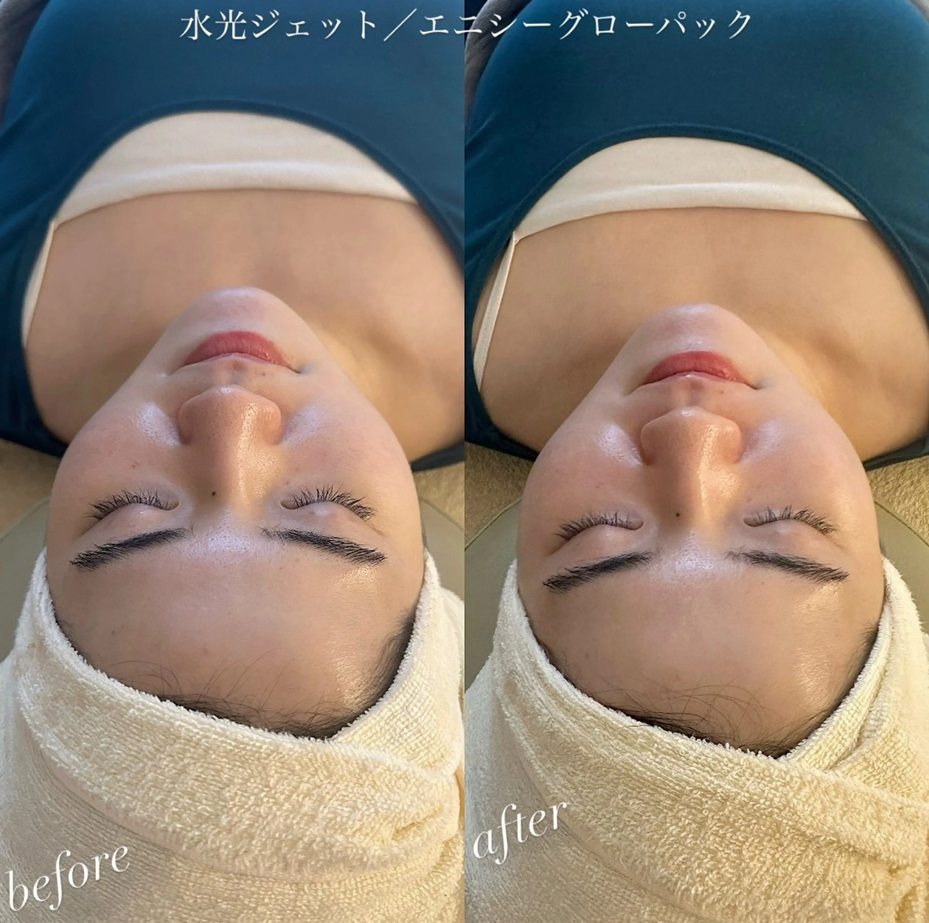 うなじ脱毛/美肌脱毛 LABELのエステ・リラクイメージ