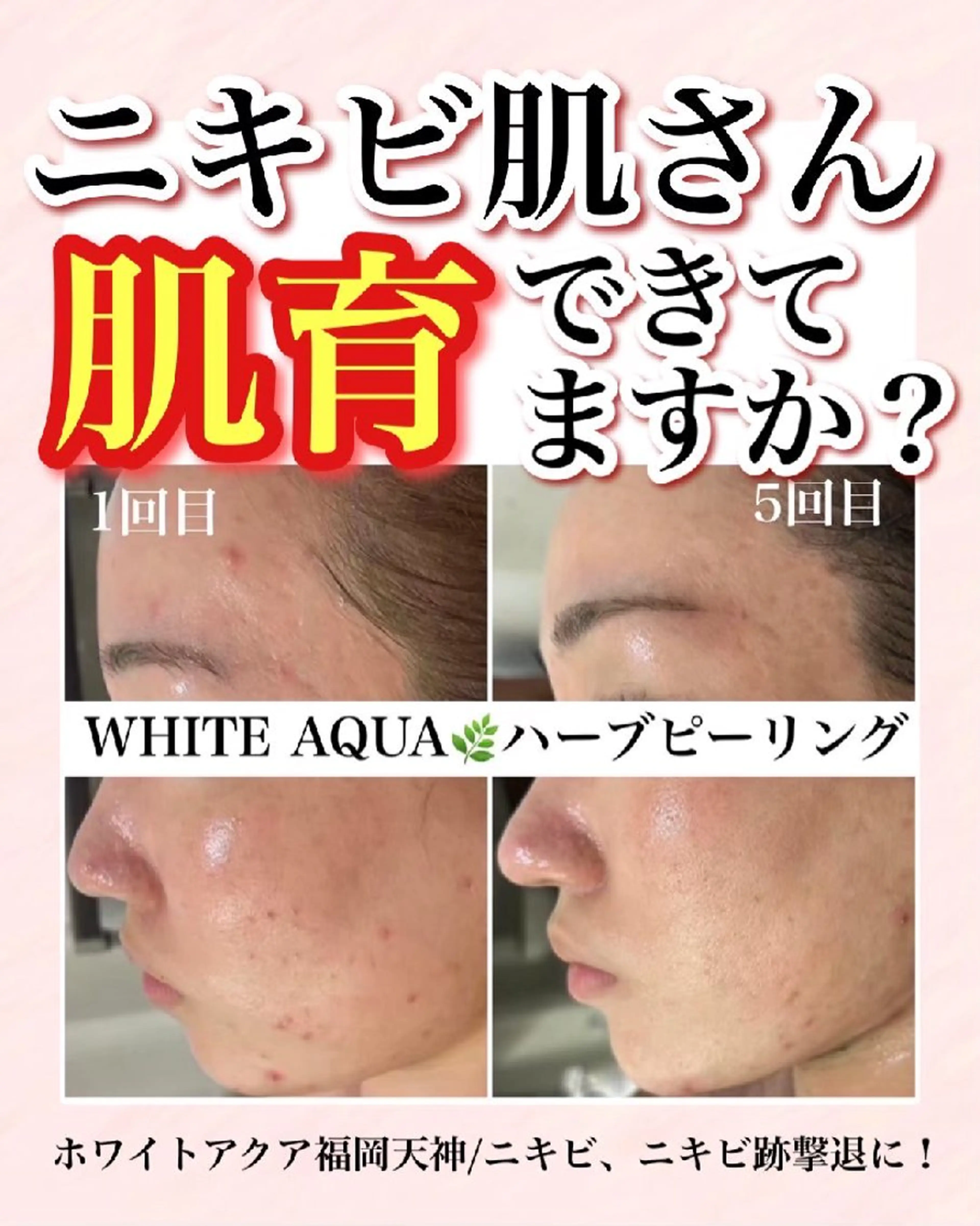 メンズ キッズ WHITEAQUA 福岡天神店のエステ・リラクイメージ