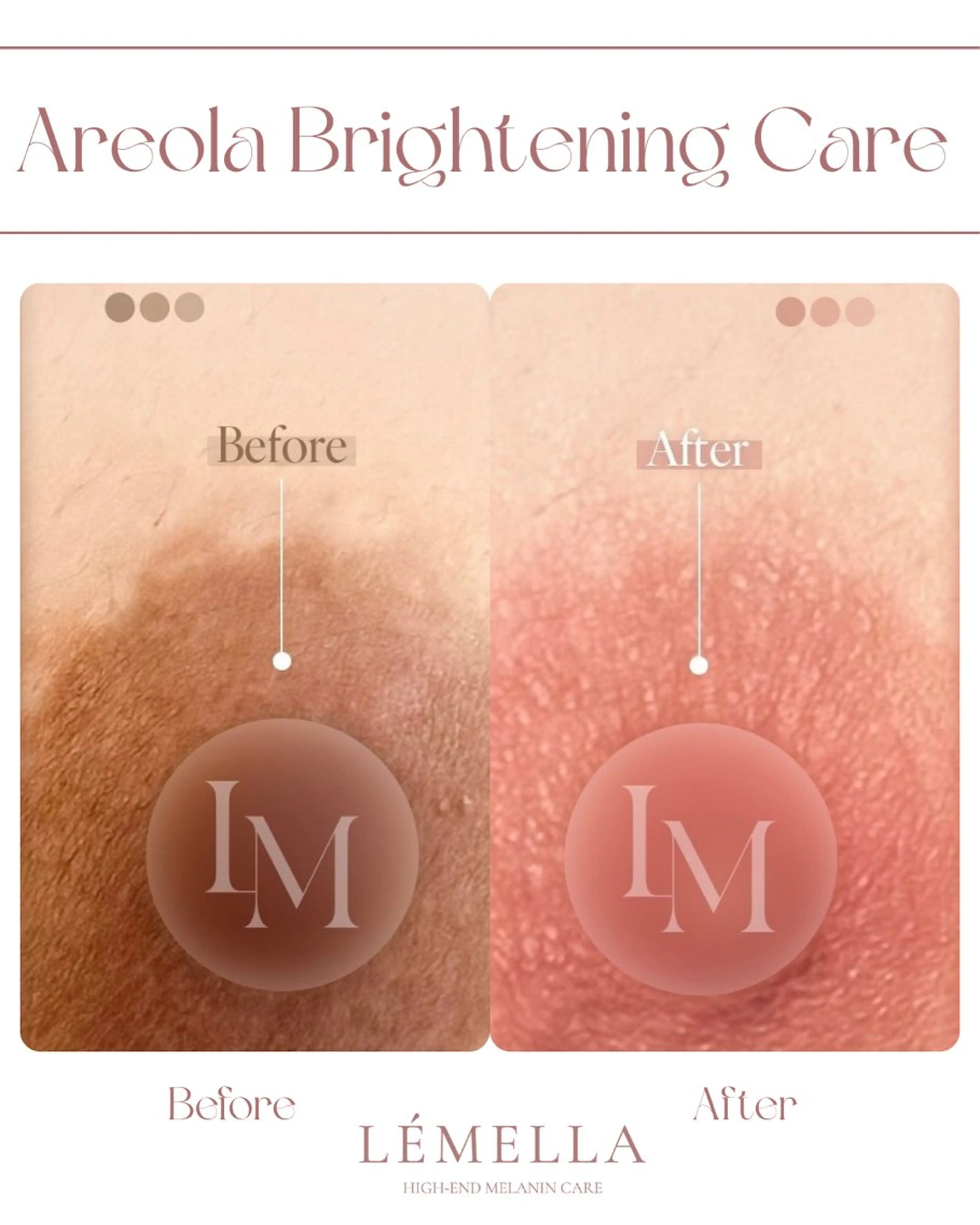 aimer所属・aimer 島田のエステ・リラクイメージ