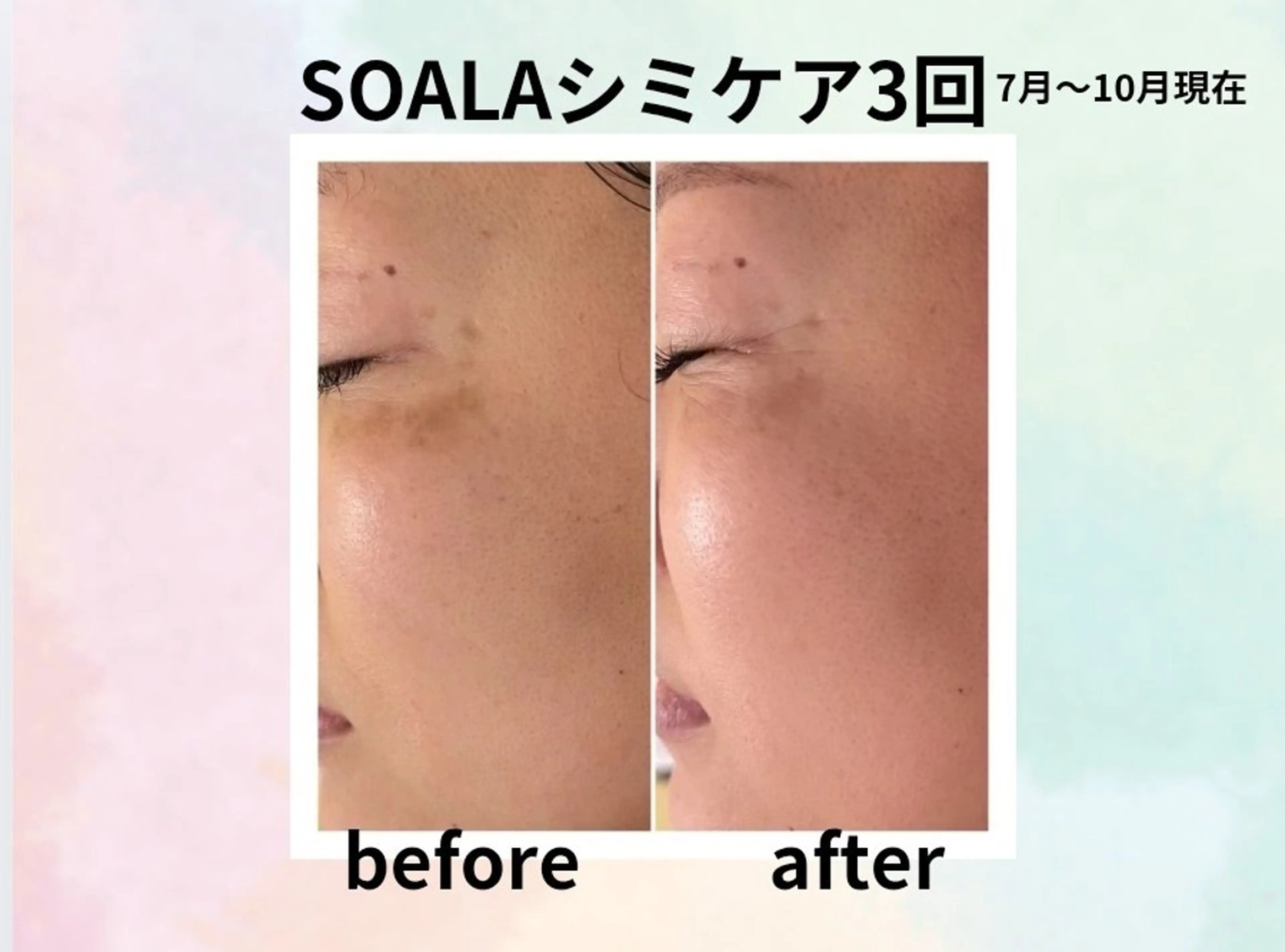 エステ 美容整体師  江上のエステ・リラクイメージ