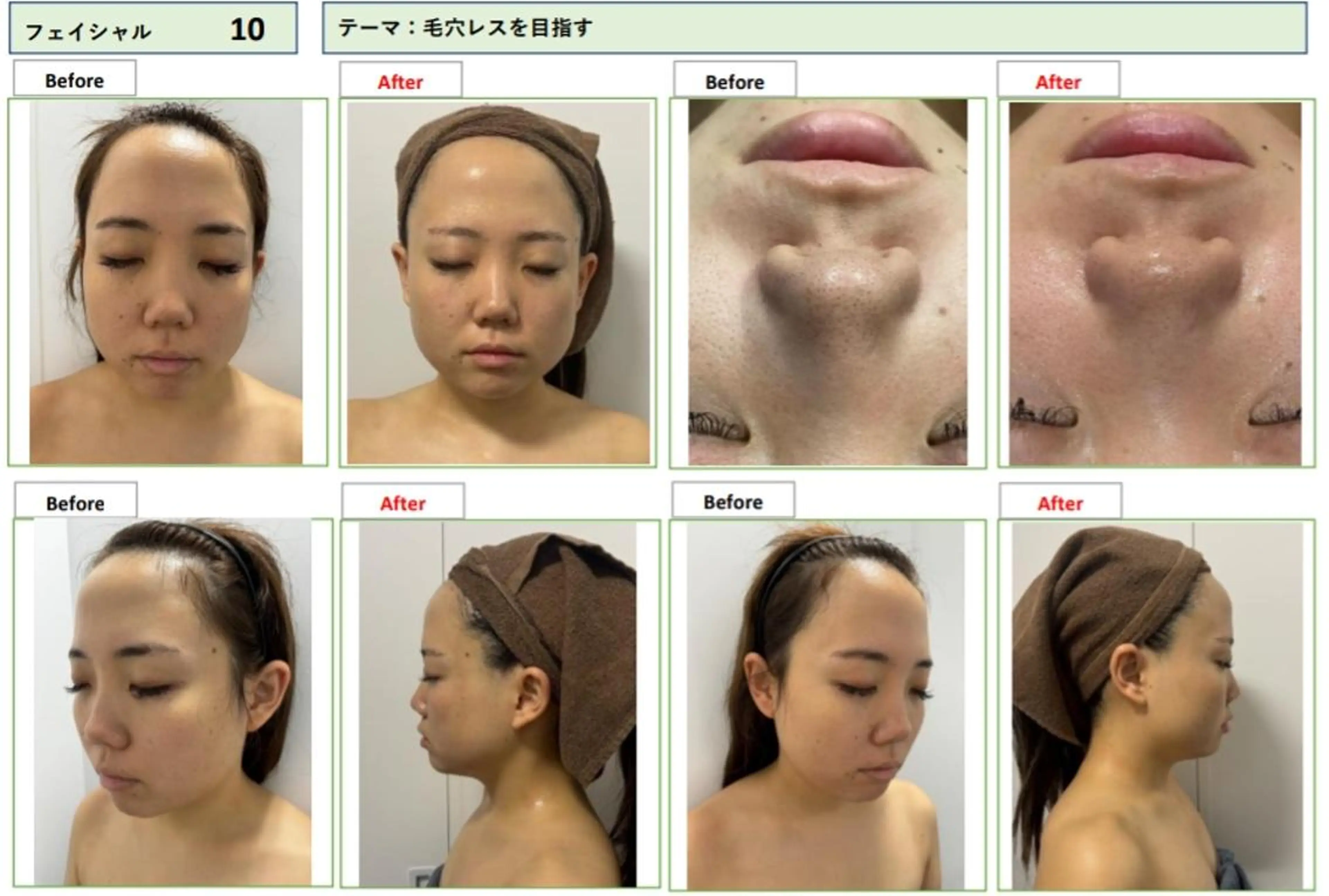 エステ リラク U24💗学割エステ 💗RAYVIS池袋のエステ・リラクイメージ