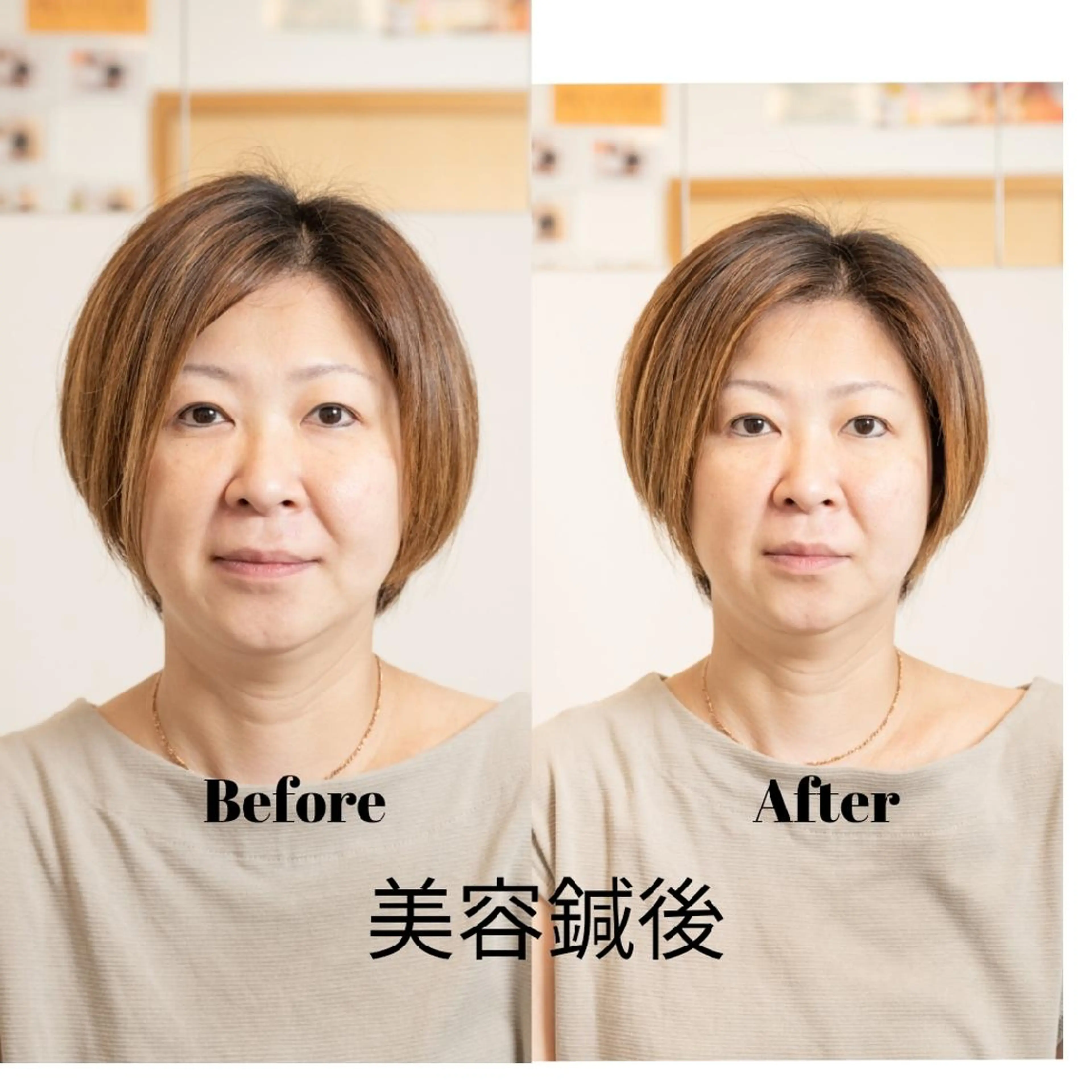 北梅田美容鍼灸院所属・美容鍼マイスター 川村　淳のエステ・リラクイメージ