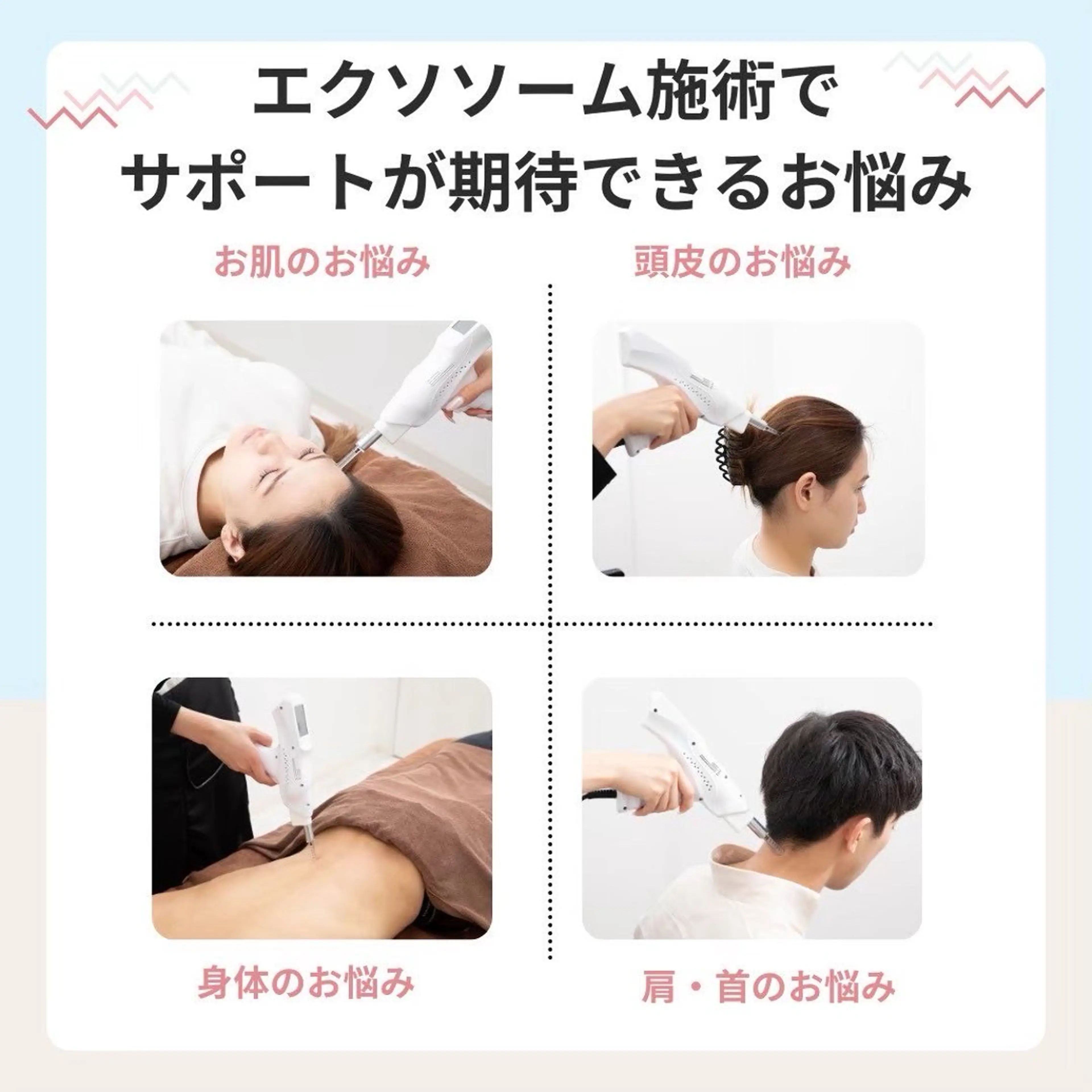 【今話題！】幹細胞培養上清液24,200円→12,100円　⚠️リクエスト予約のみの写真