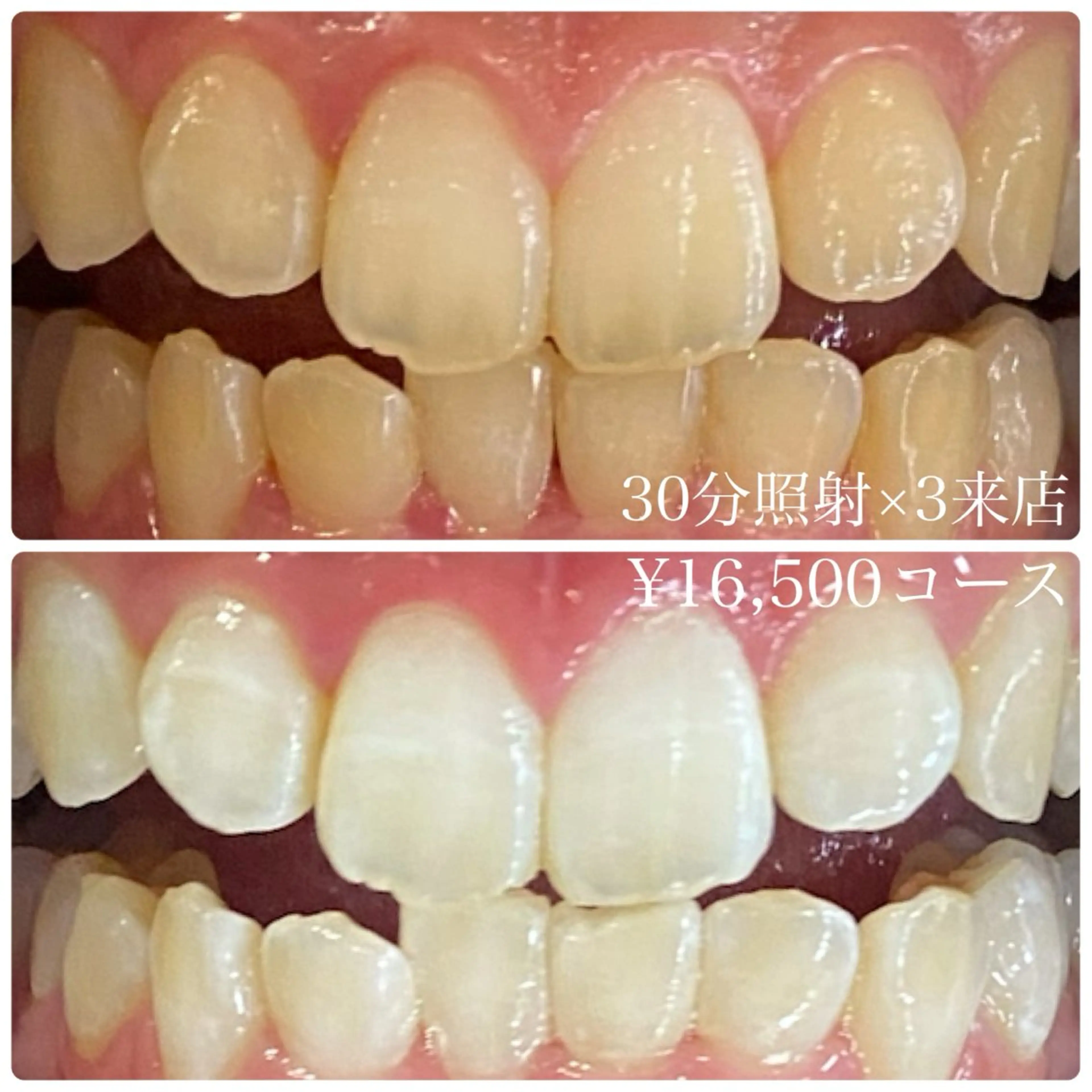 メンズ その他 ホワイトニングルーム　川崎店所属・ホワイトニング ルーム　川崎店のその他イメージ