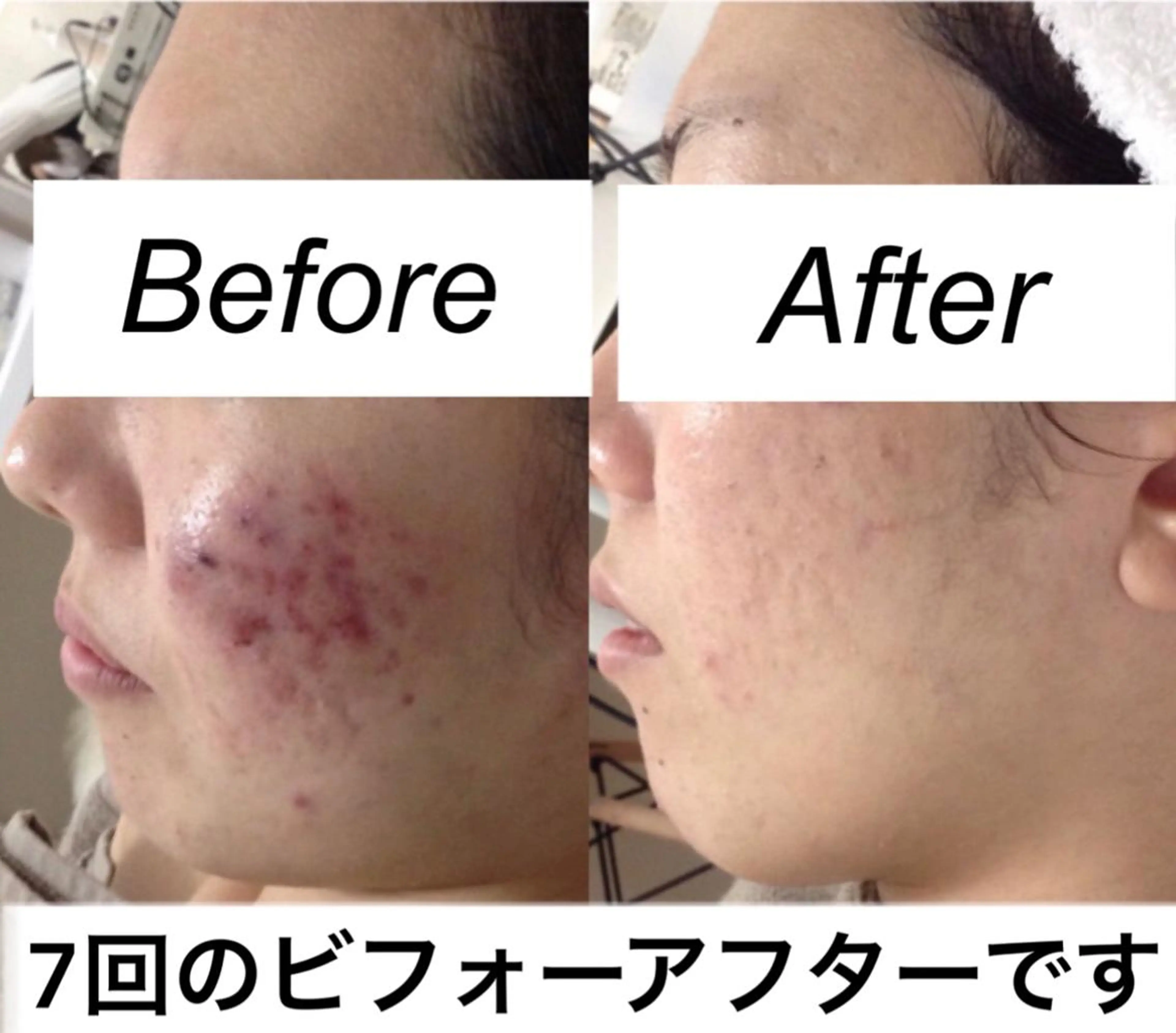 エステ リラク 都度払い肌質改善 &脱毛Blancheのエステ・リラクイメージ