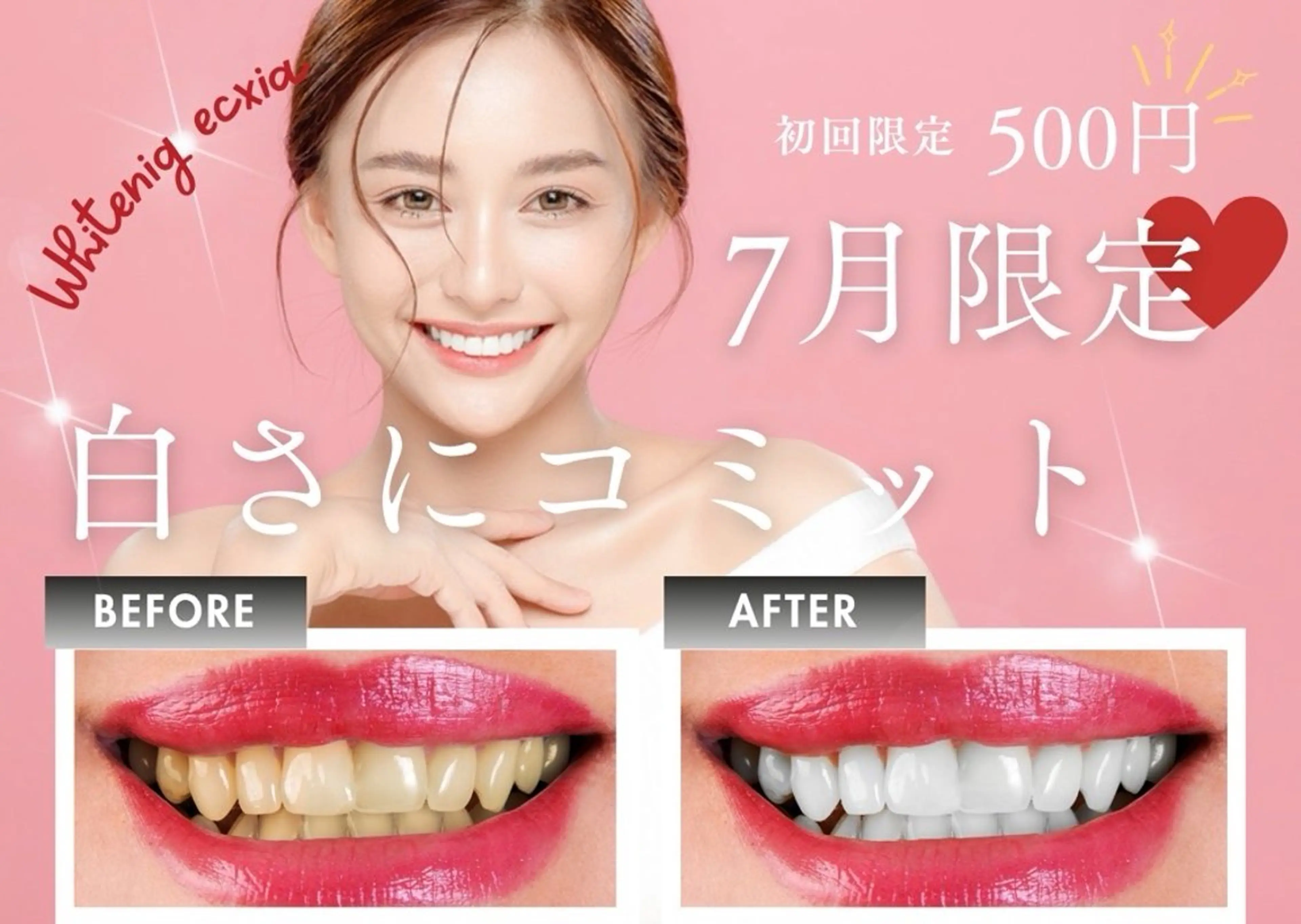 【7月限定】強力！歯のセルフホワイトニング（9分2セット）1回3980円→500円の写真