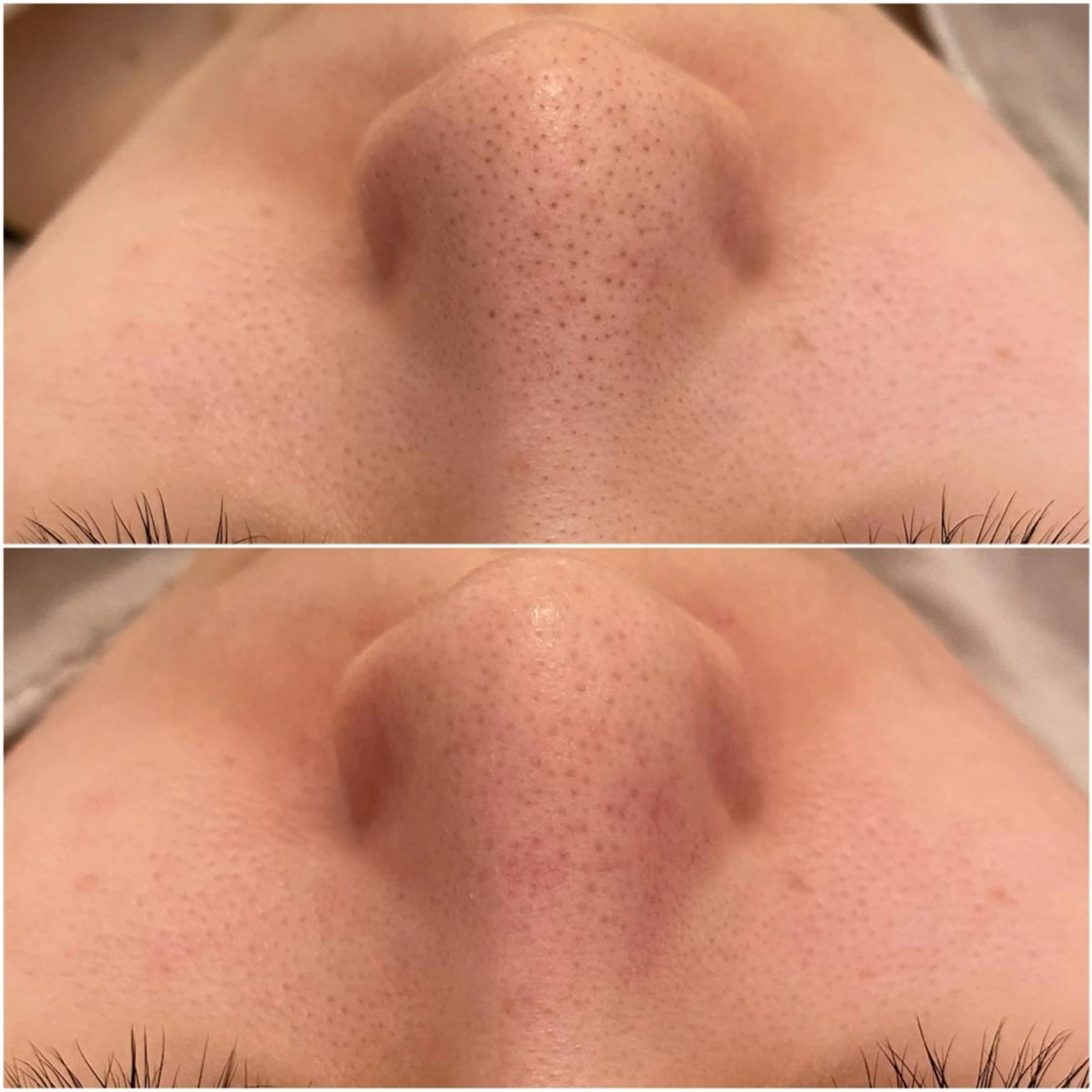 ✨美肌水光✨ アトリエリュバンのエステ・リラクイメージ