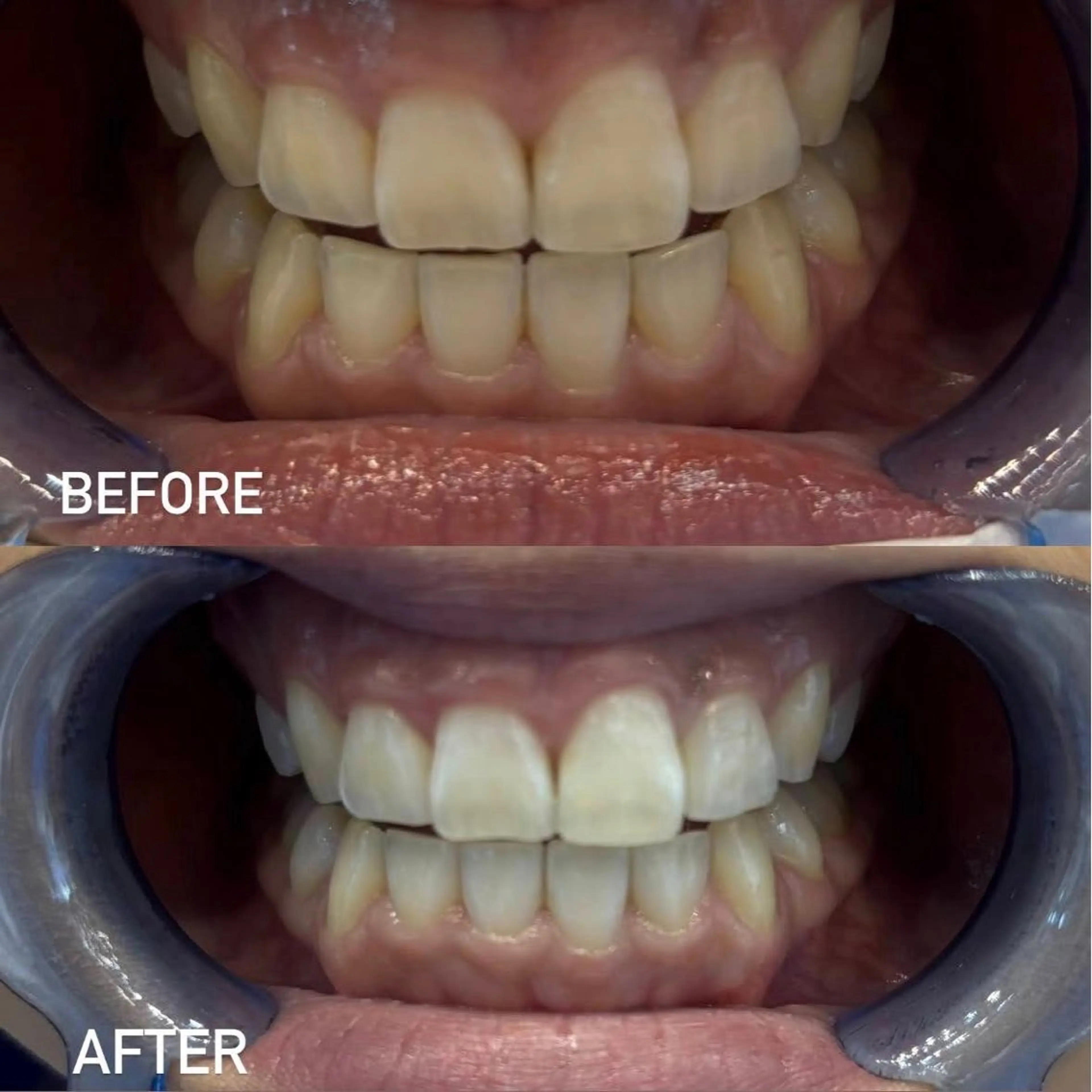 ホワイトニングサロンaile所属・セルフホワイトニング 金城しおりのその他イメージ