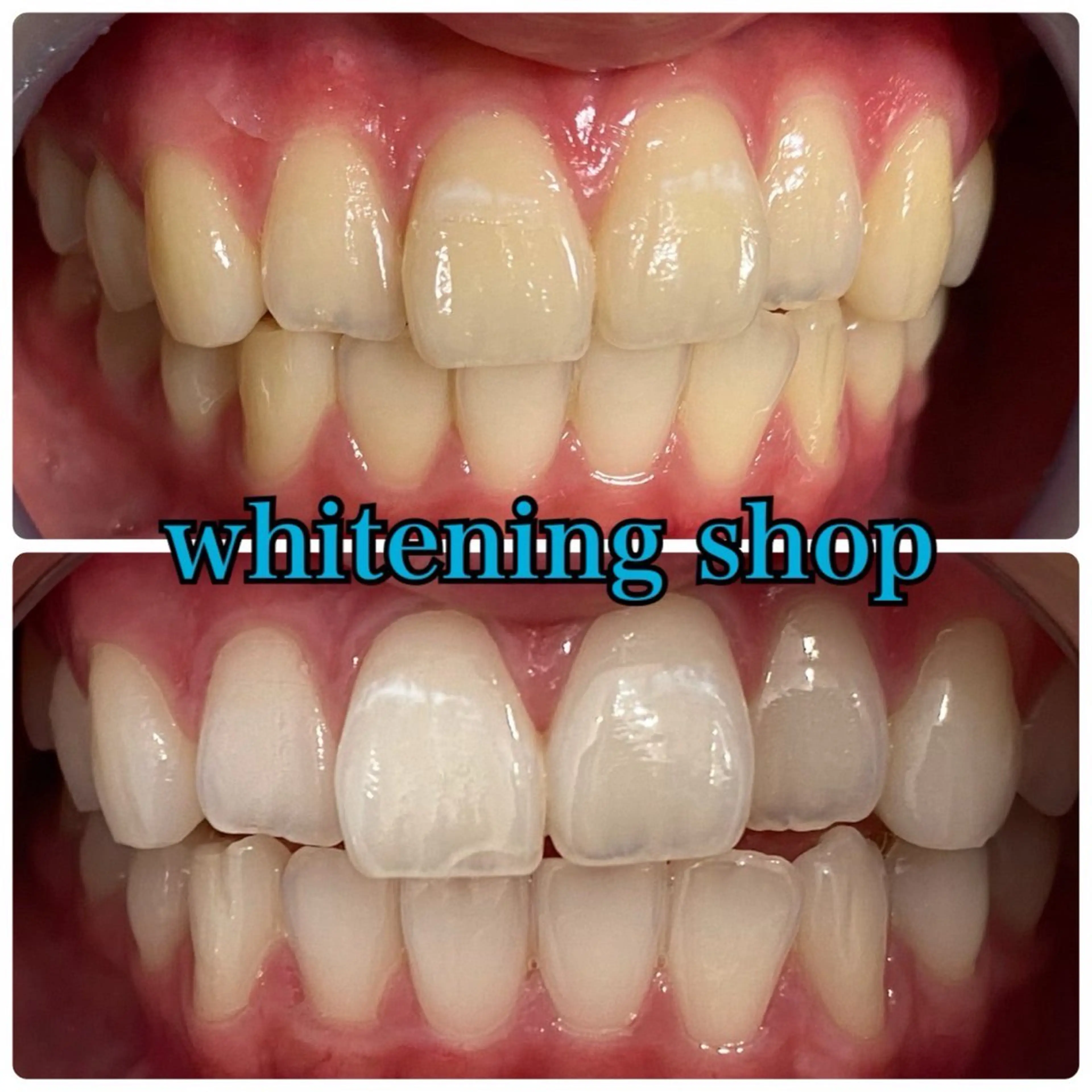 メンズ エステ リラク ホワイトニング ショップ川越店のエステ・リラクイメージ