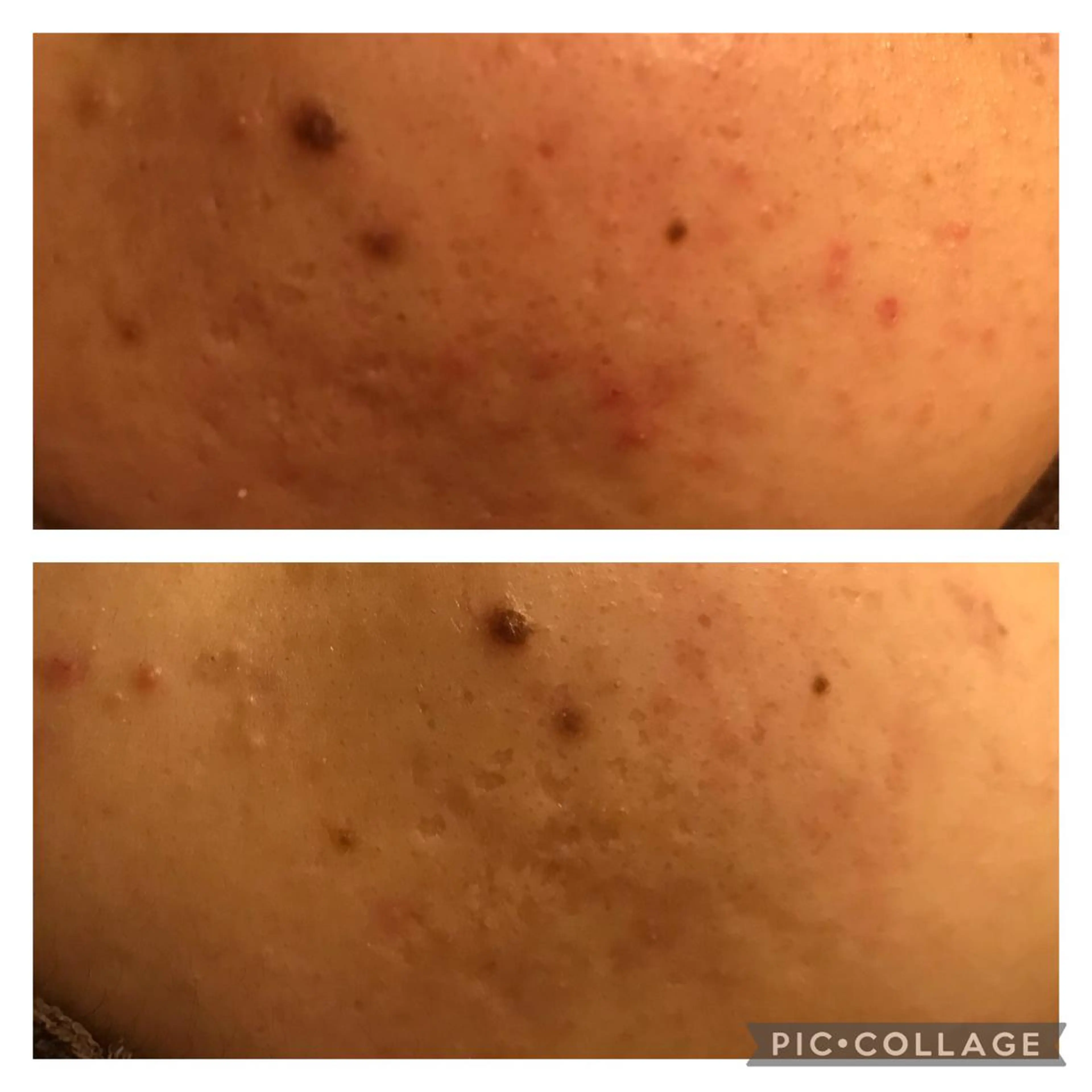 ミディアム カラー パーマ ヘアアレンジ メンズ キッズ ネイル マツエク・マツパ 赤色 アニメ,Vオタク× 即効痩せエステサロンのエステ・リラクイメージ