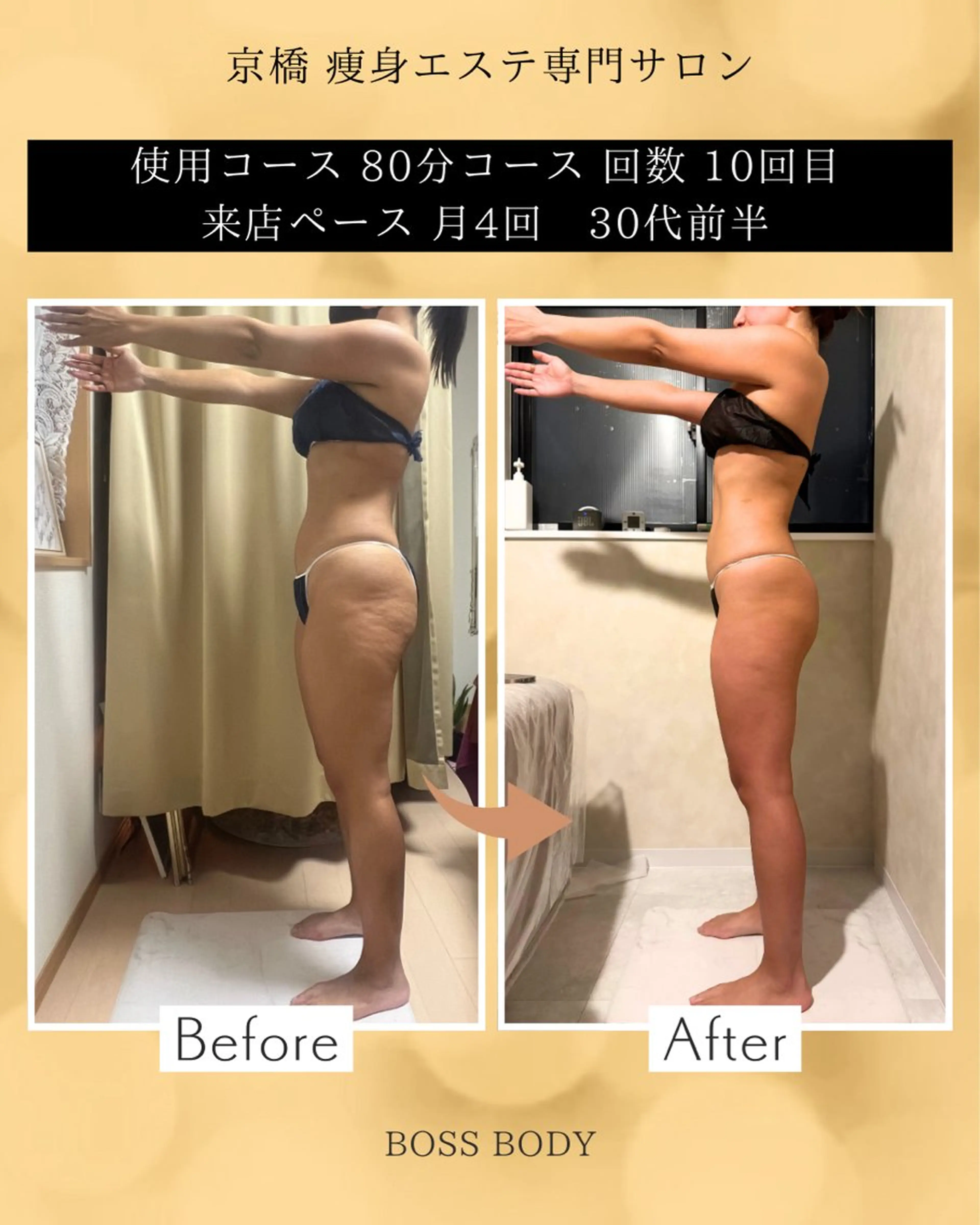 京橋 痩身エステ専門サロン BOSS  BODY所属・京橋痩身エステ専門サ ロンBOSSBODYのエステ・リラクイメージ