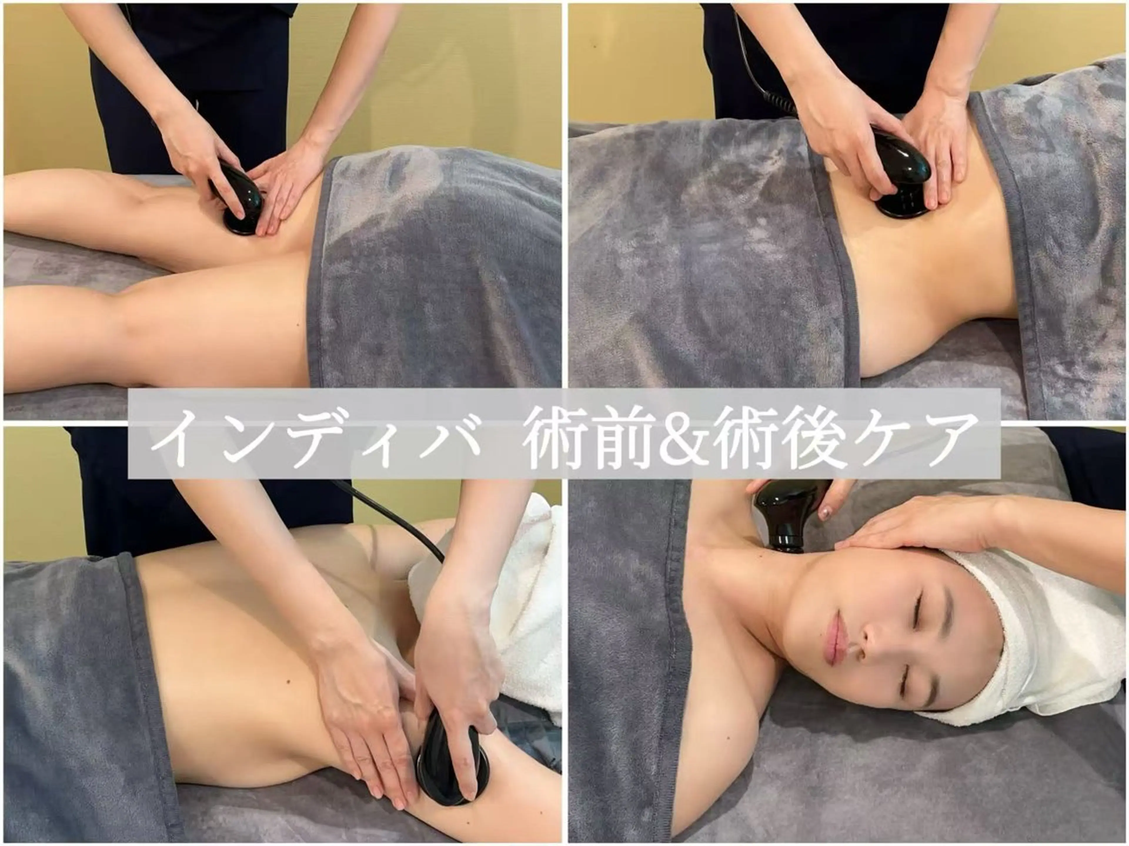 【インディバ術後ケア※ボディ＆顔60分】こうしゅく改善！術後ケア　9800円の写真