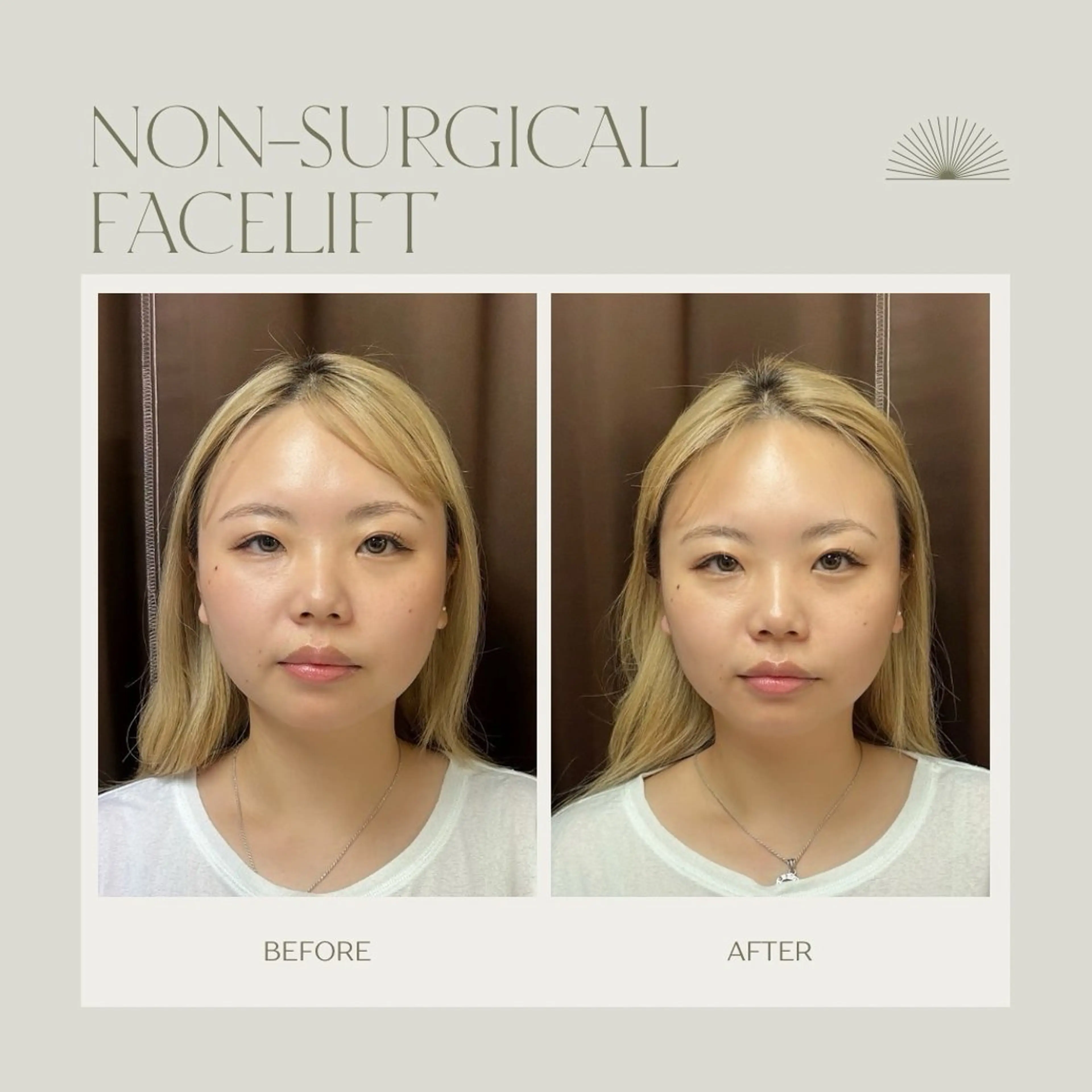 エステ リフュージュ所属・リフュージュ隠れ家 八王子の眉毛・アイブロウイメージ