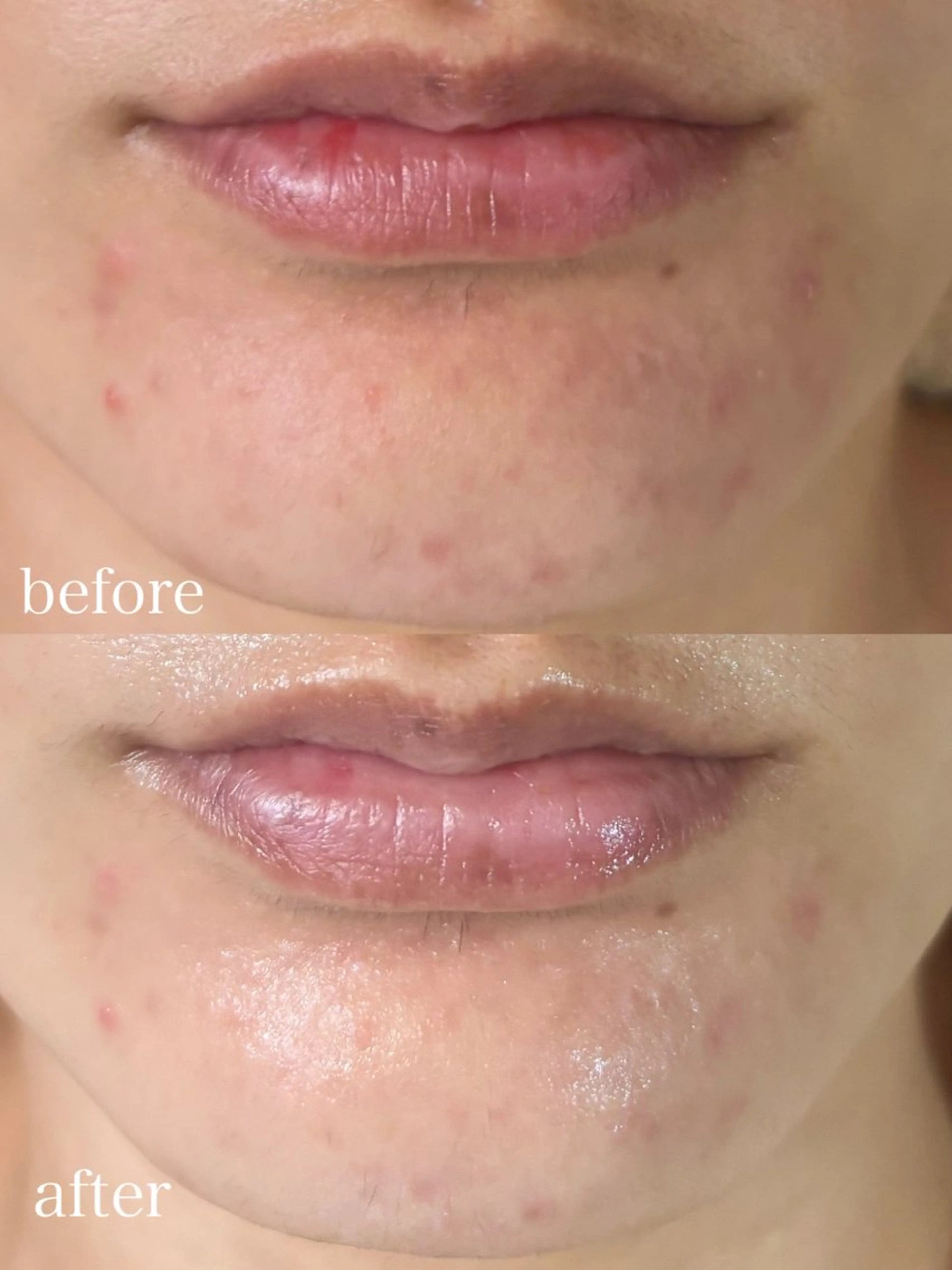 WHITE AQUA 北千住店のエステ・リラクイメージ