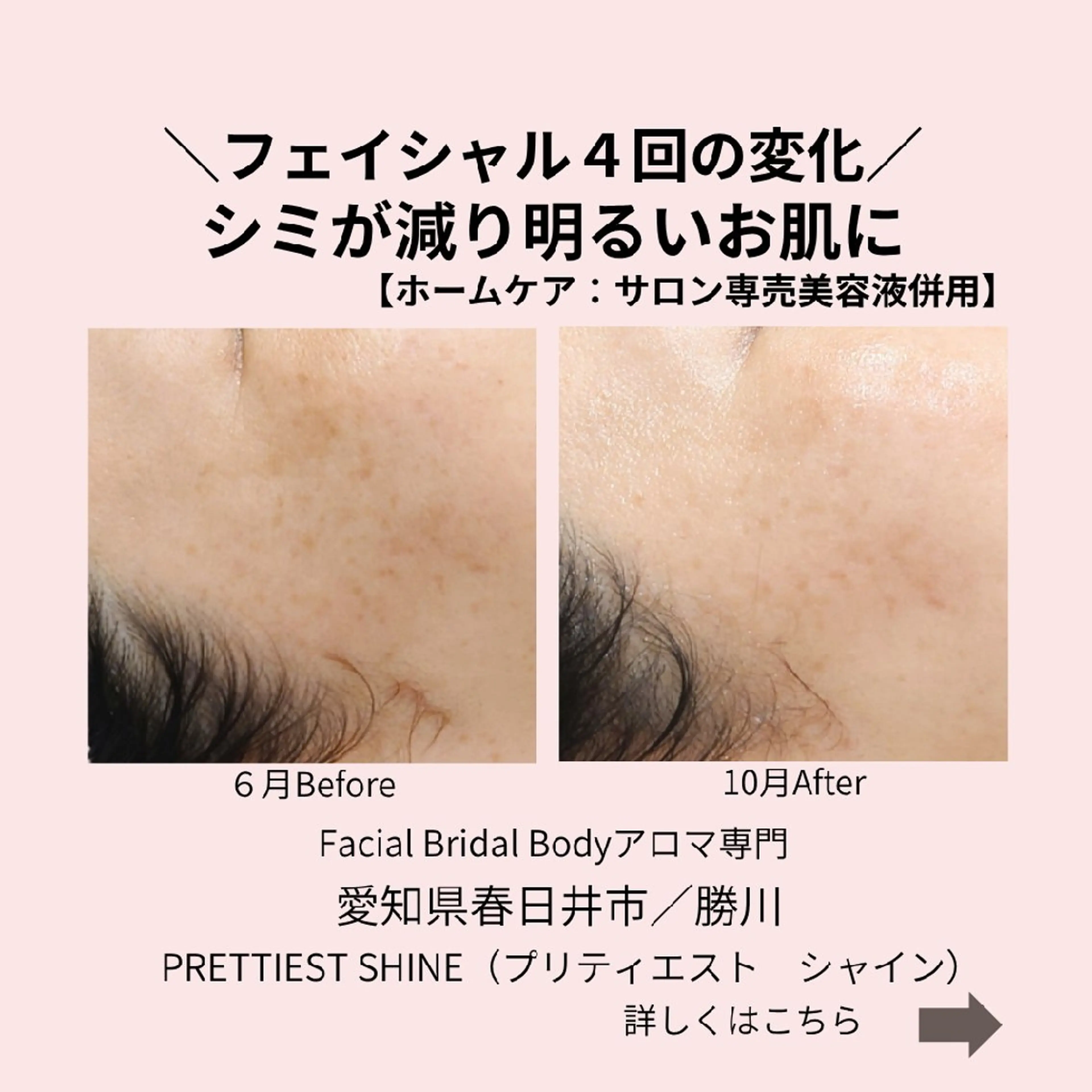 エステ PRETTIEST SHINE所属・山田 浩子のエステ・リラクイメージ