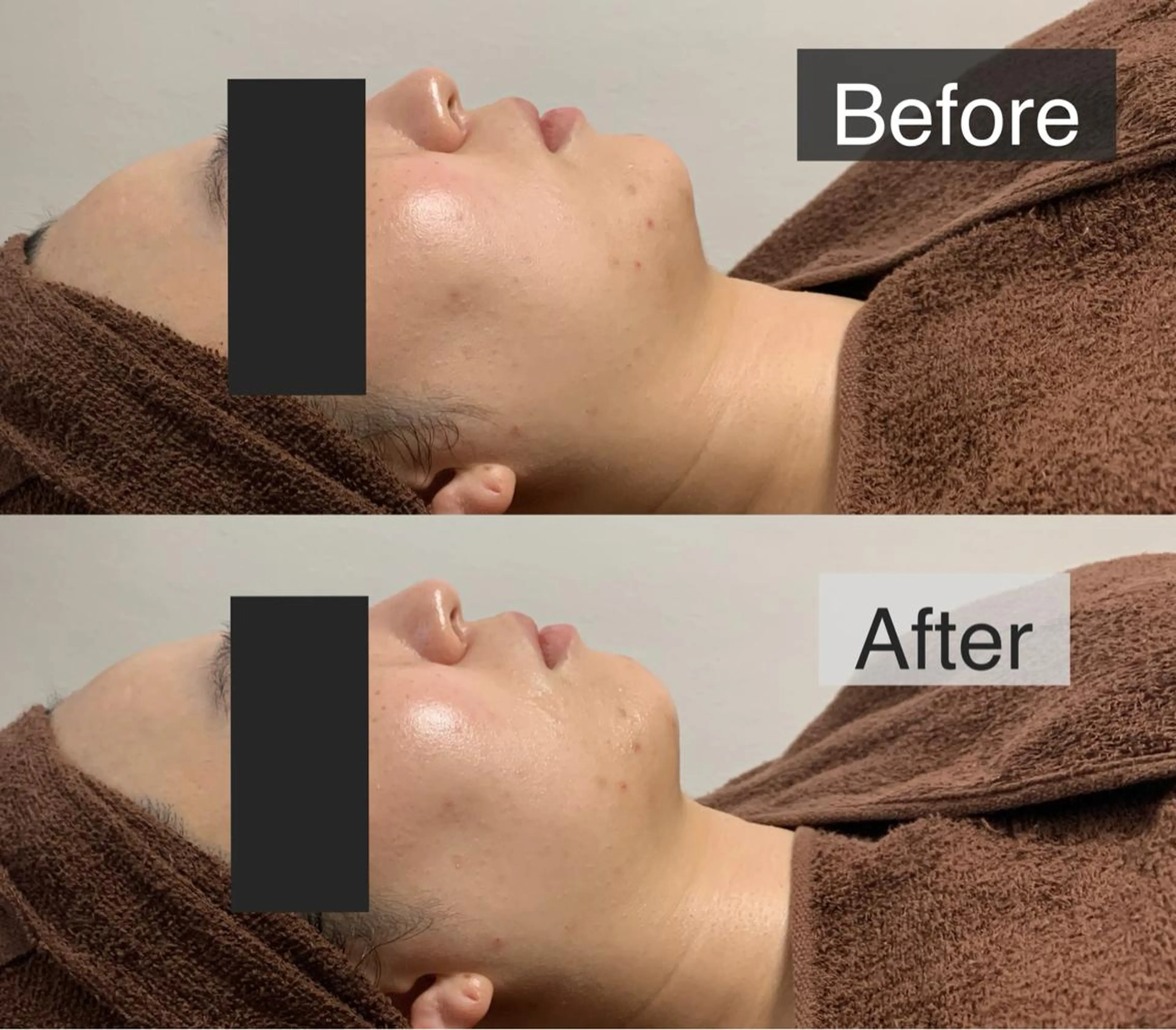 脱毛専門サロン BELFINE恵比寿のエステ・リラクイメージ