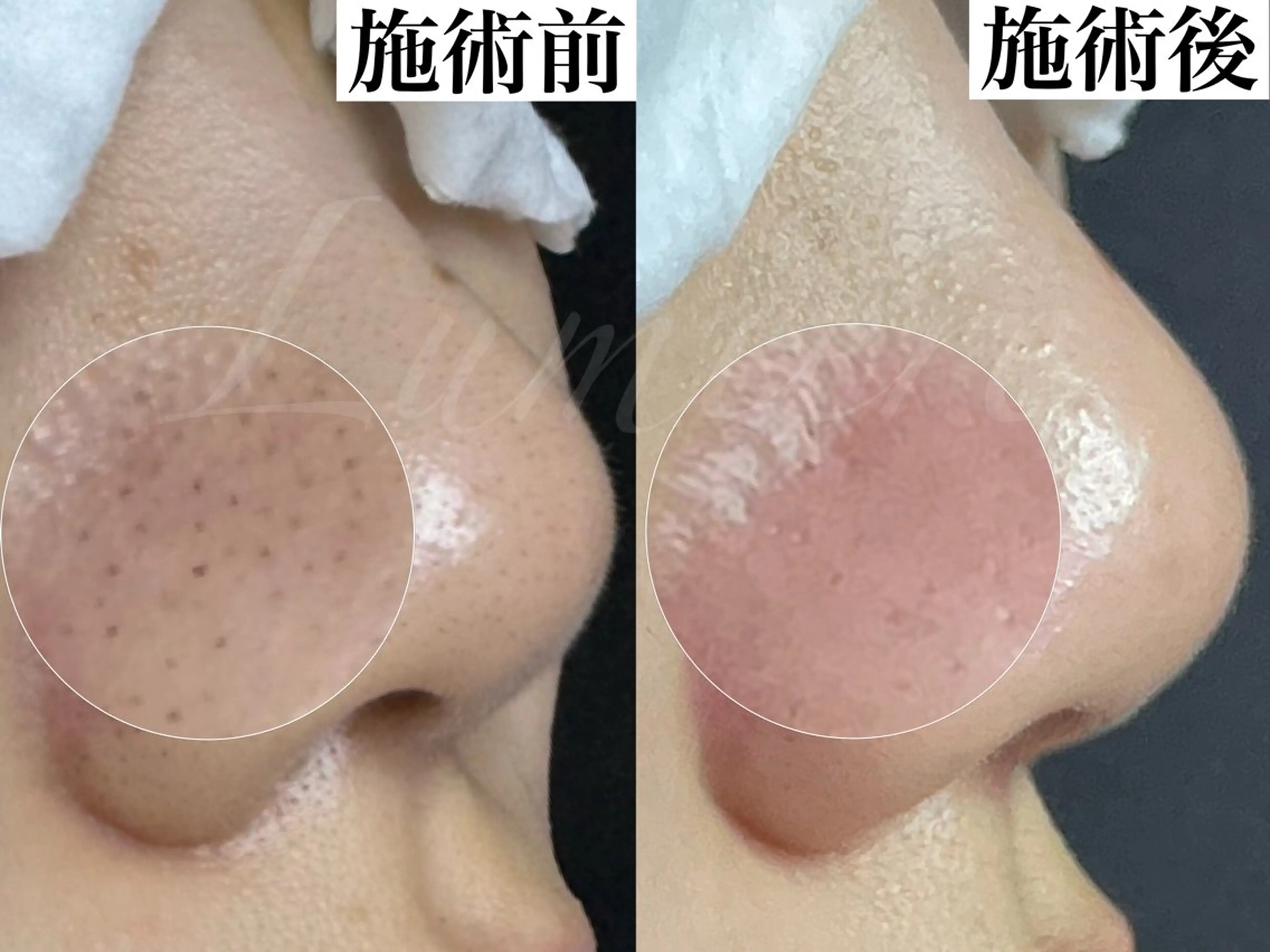 毛穴が綺麗になる 隠れ家サロン　南森町のエステ・リラクイメージ