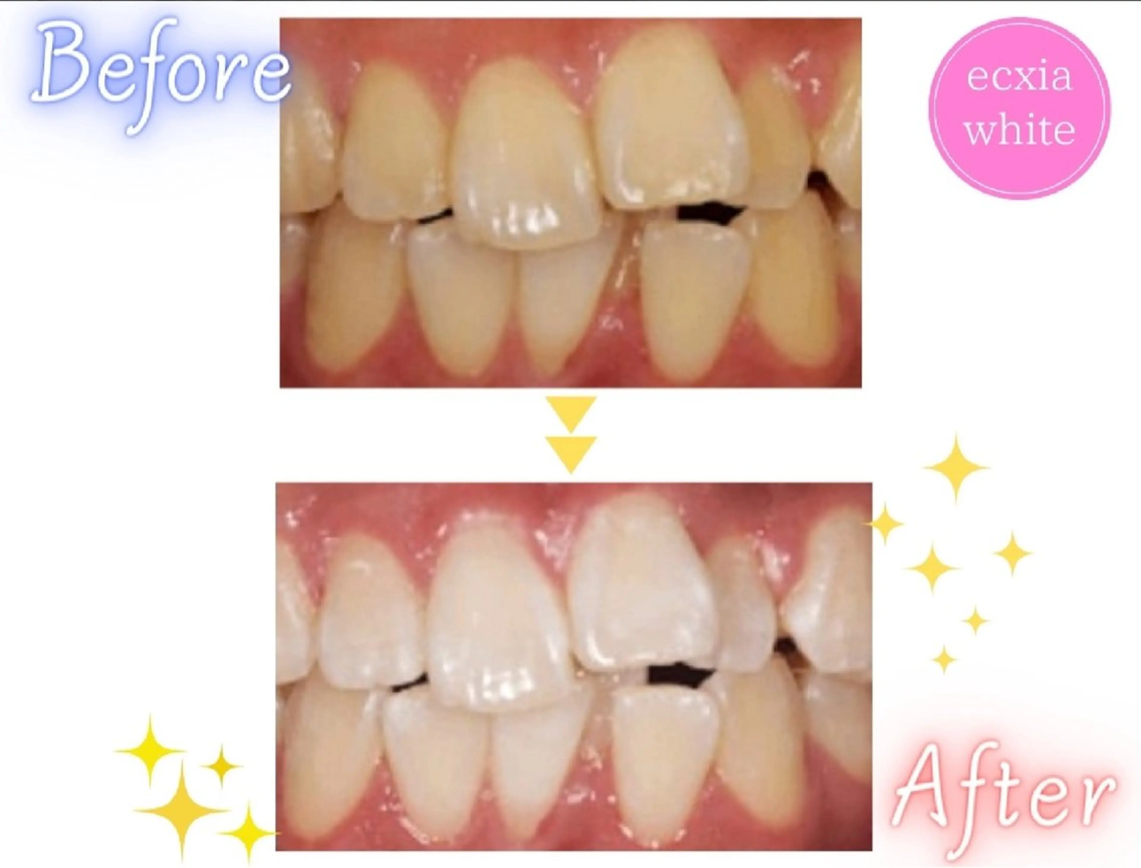 その他 エクシアホワイト エミフルMASAKIのその他イメージ