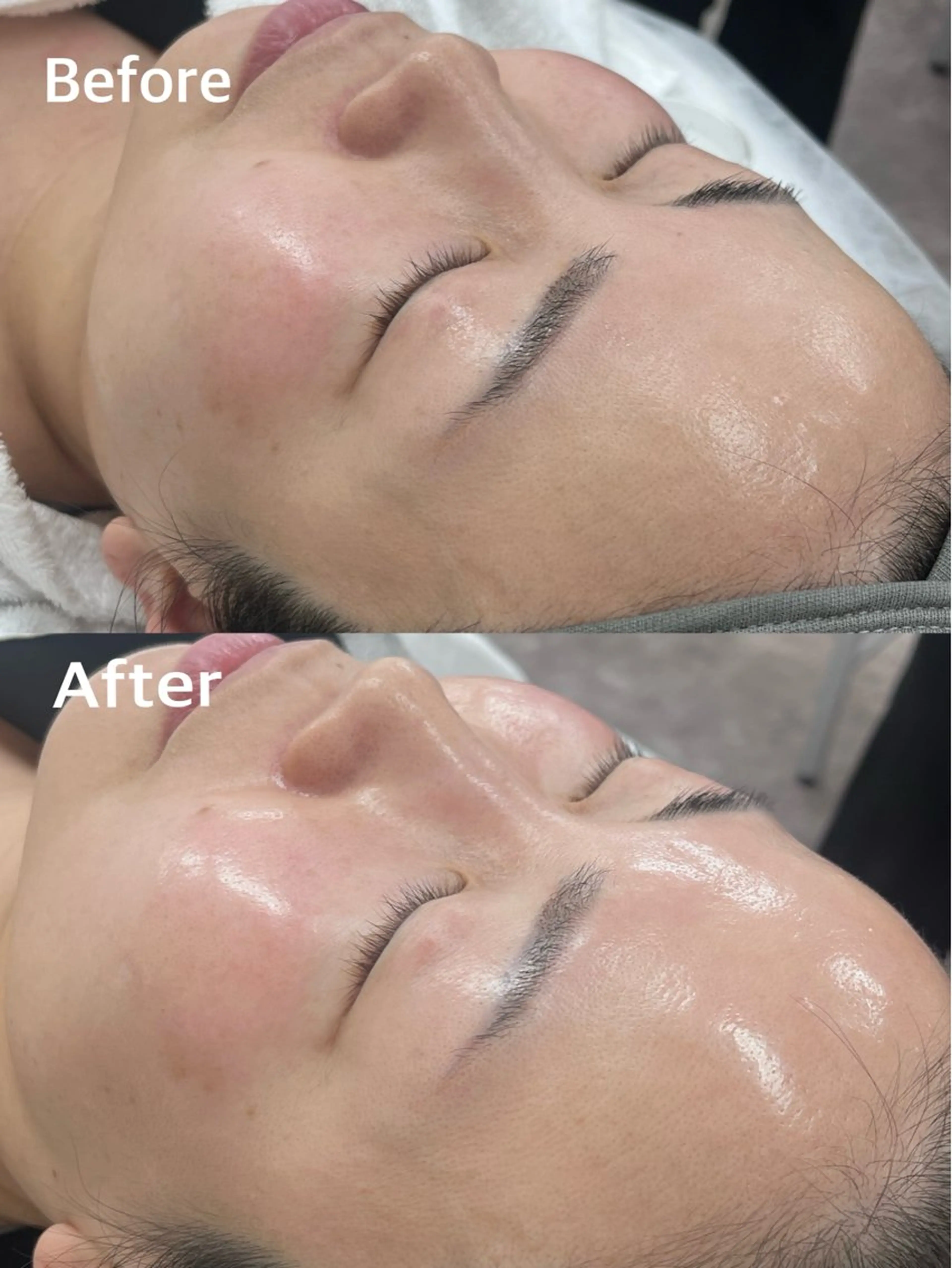 エステ クラスペディア脱毛 ・フェイシャル専門店のエステ・リラクイメージ