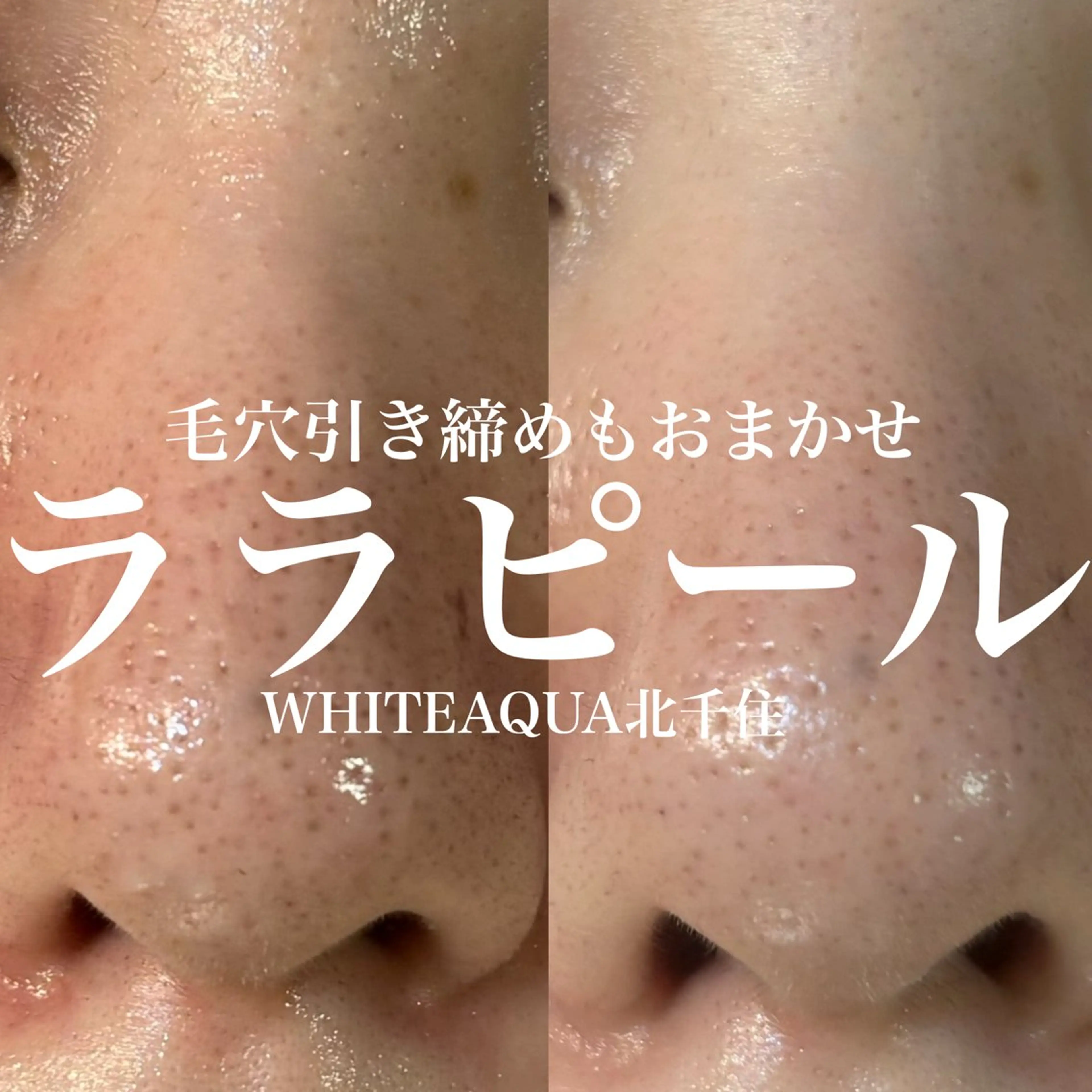 その他 WHITE AQUA 北千住店のエステ・リラクイメージ