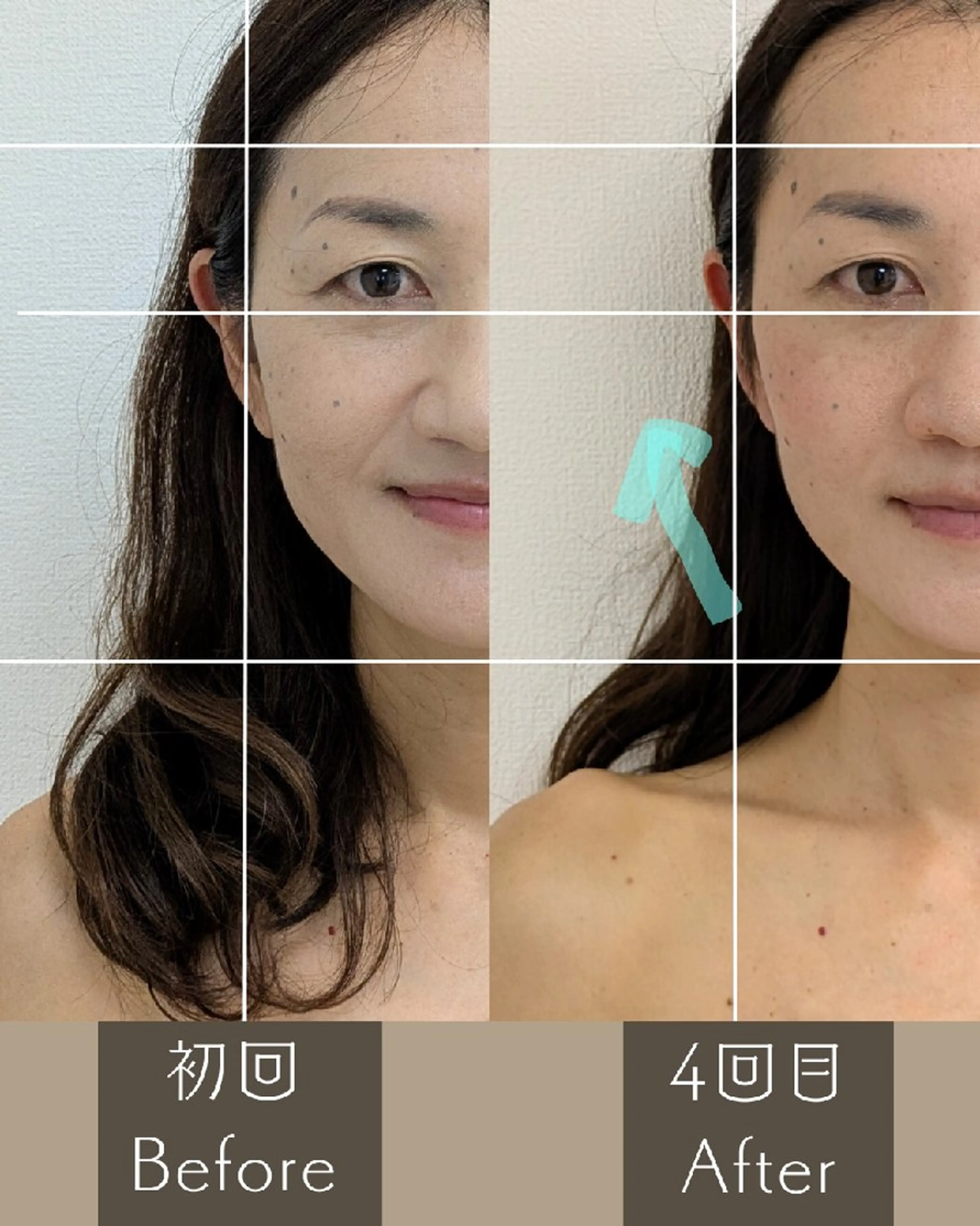 ✨️お顔の印象が変わる✨️整顔プレミアム70分💆お顔のお悩みだけでなく自律神経にも😌の写真