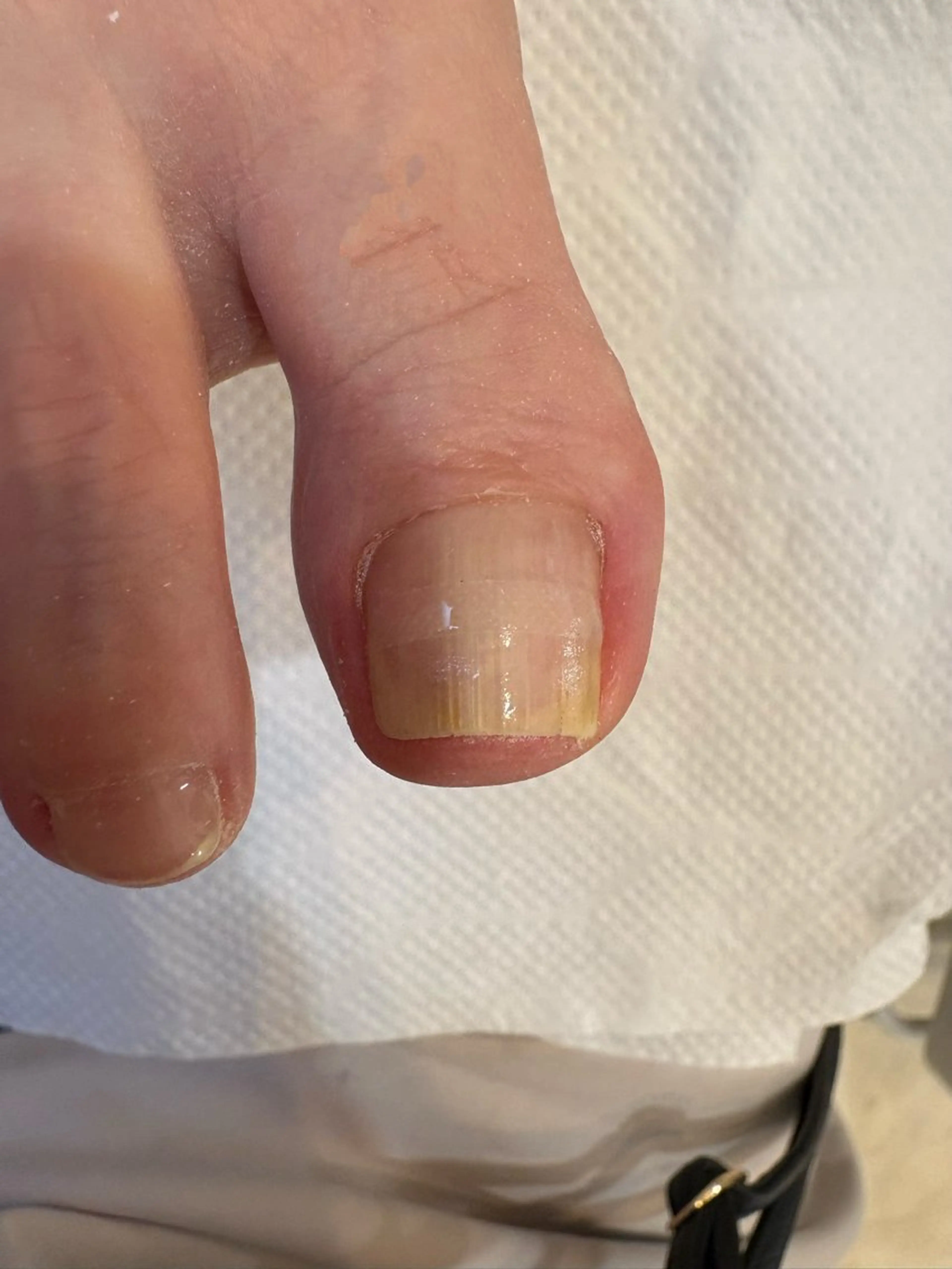 ネイル その他(ネイル) ネイルサロンailes所属・ネイルサロンエール 店長沼尻のネイルデザイン