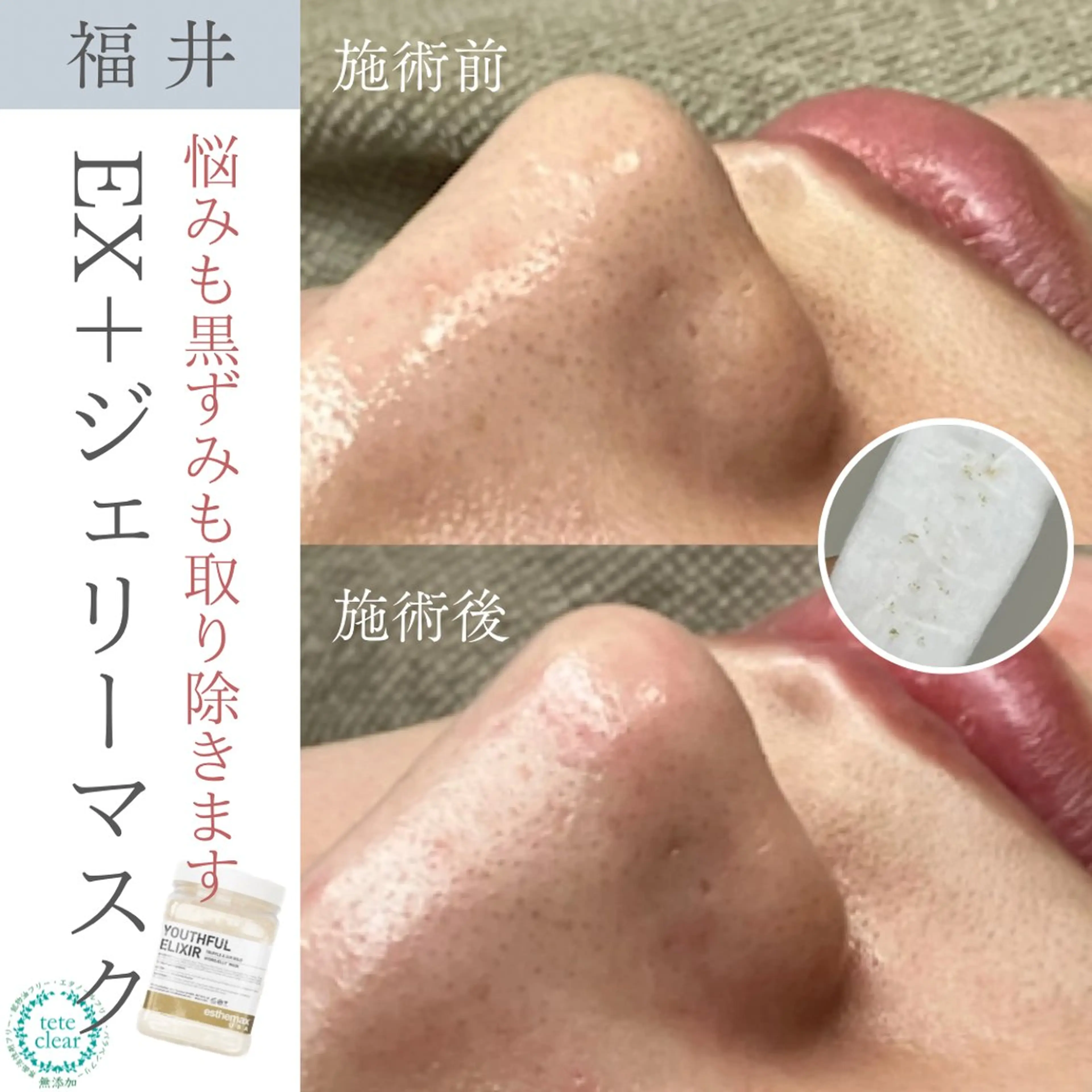 毛穴ケア専門サロン Yourmeユアミーのエステ・リラクイメージ