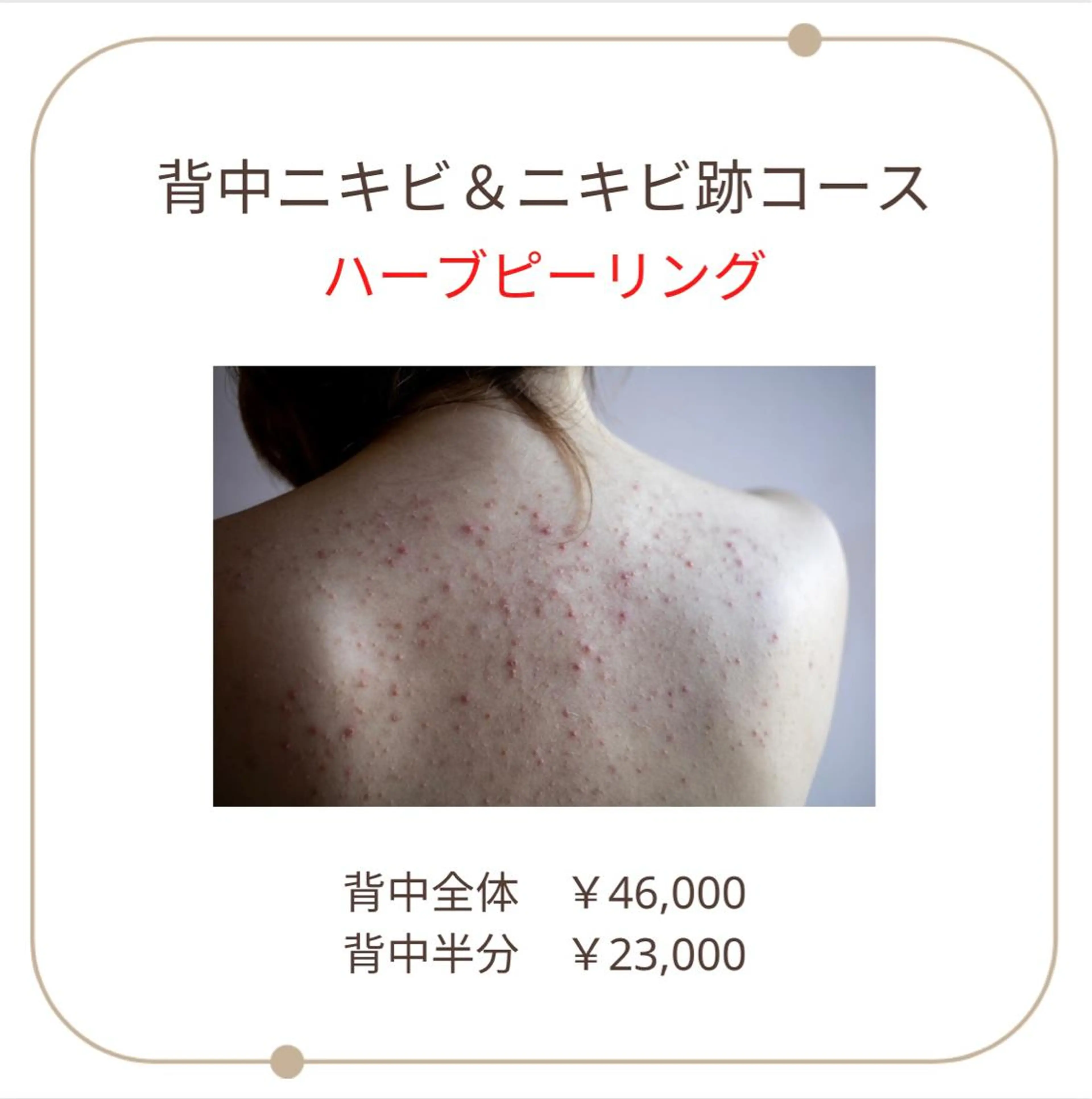エステ ベラージュ【美背中・ 美尻・フェイシャル】のエステ・リラクイメージ