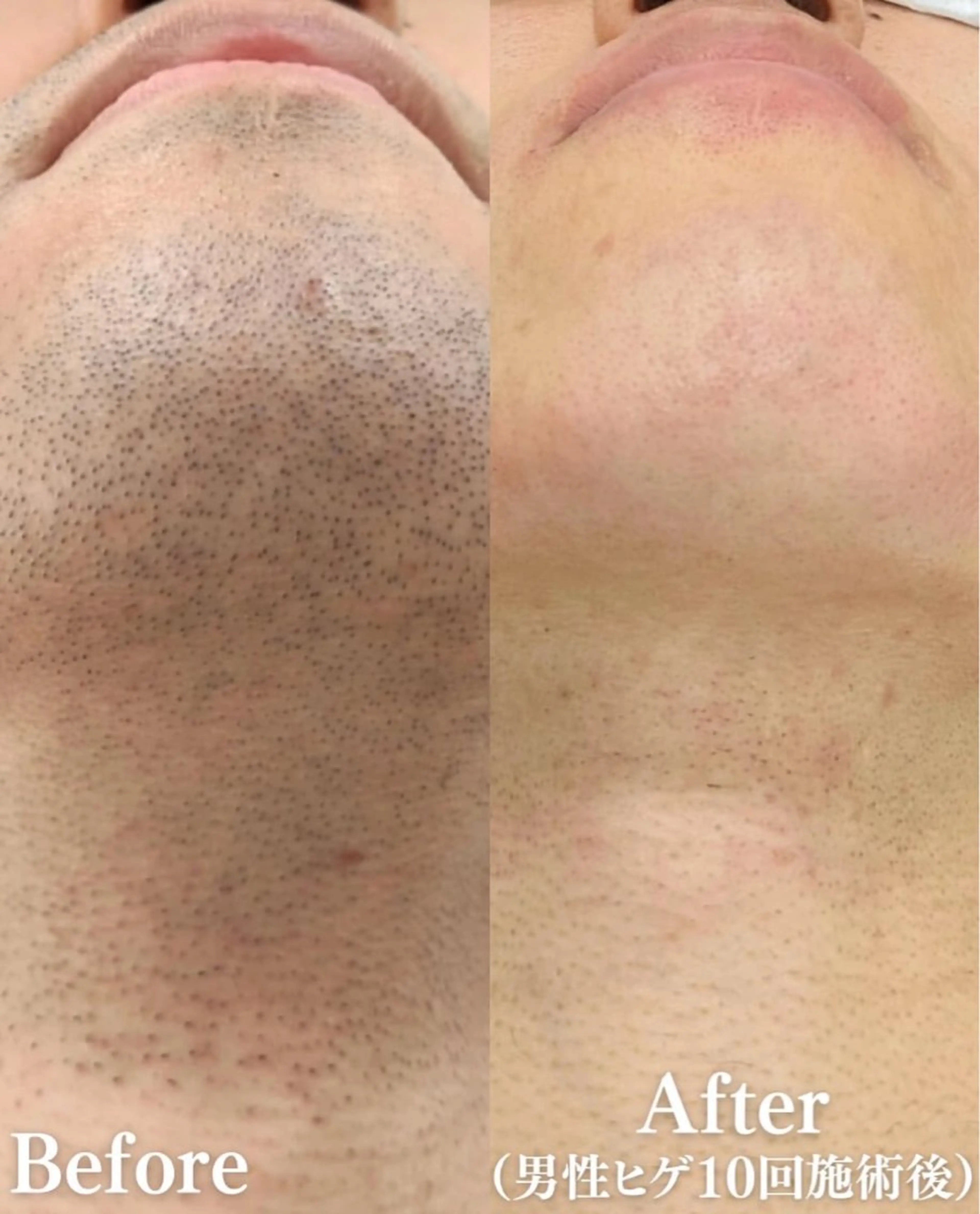 More   Beauty所属・More Beautyのエステ・リラクイメージ