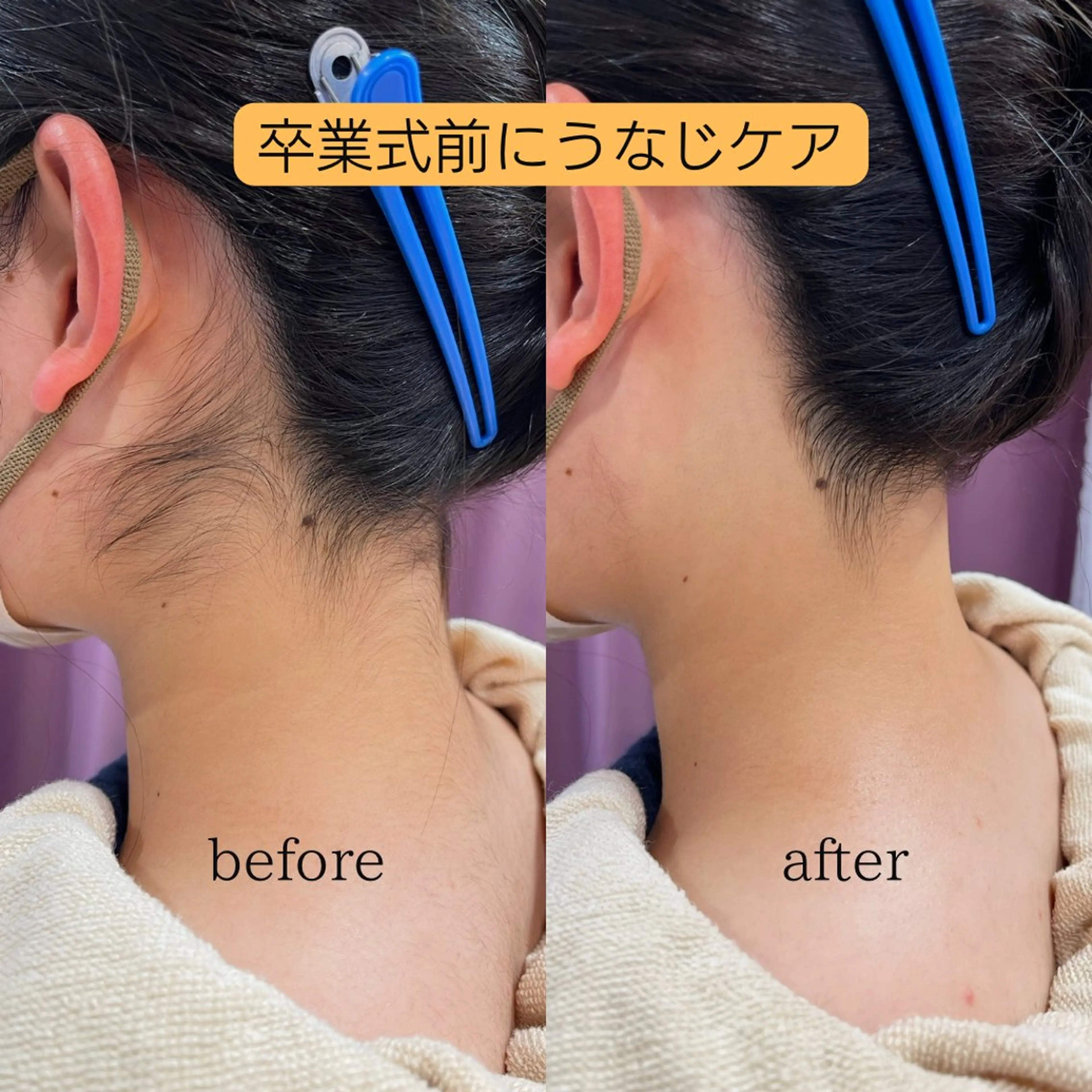 アイブロウ 眉カット その他(アイブロウ) Naps-Shaving所属・敏感肌⭐️ シェービング専門佐藤の眉毛・アイブロウイメージ