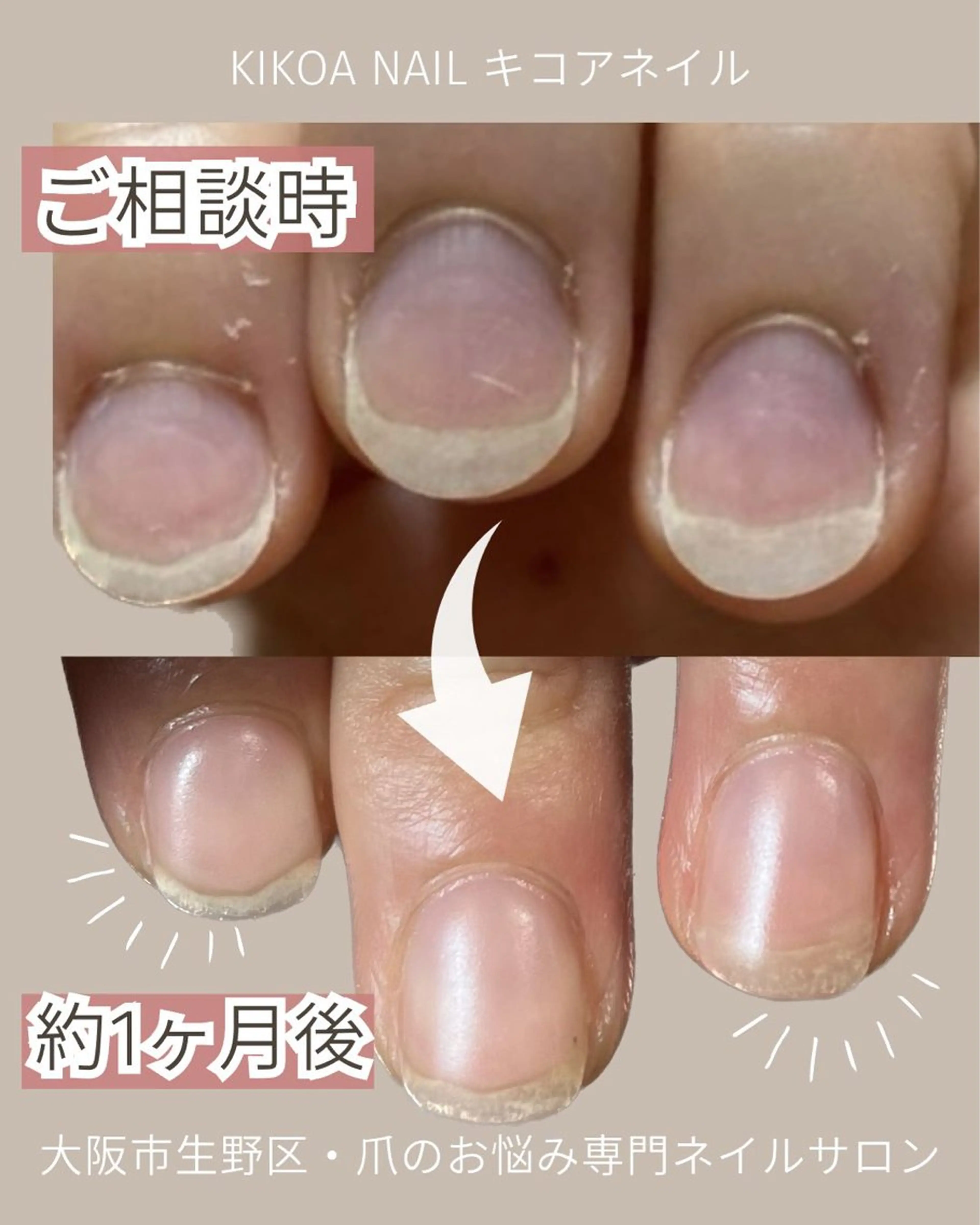 ネイル ピンク KIKOA NAIL キコアネイルのネイルデザイン